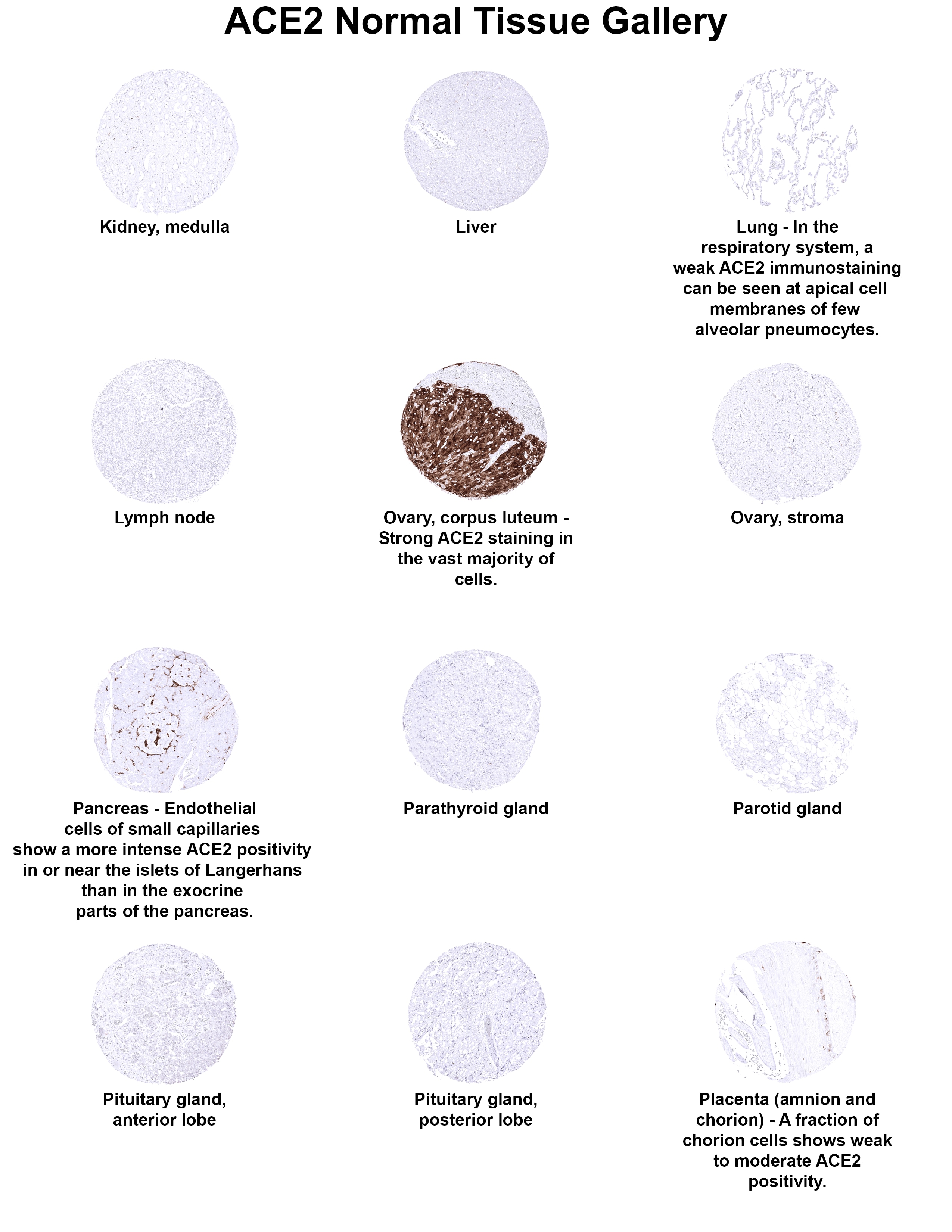 ACE-2 Antibody (MSVA-919R) - Azide and BSA Free ACE2 Normal Tissue Gallery