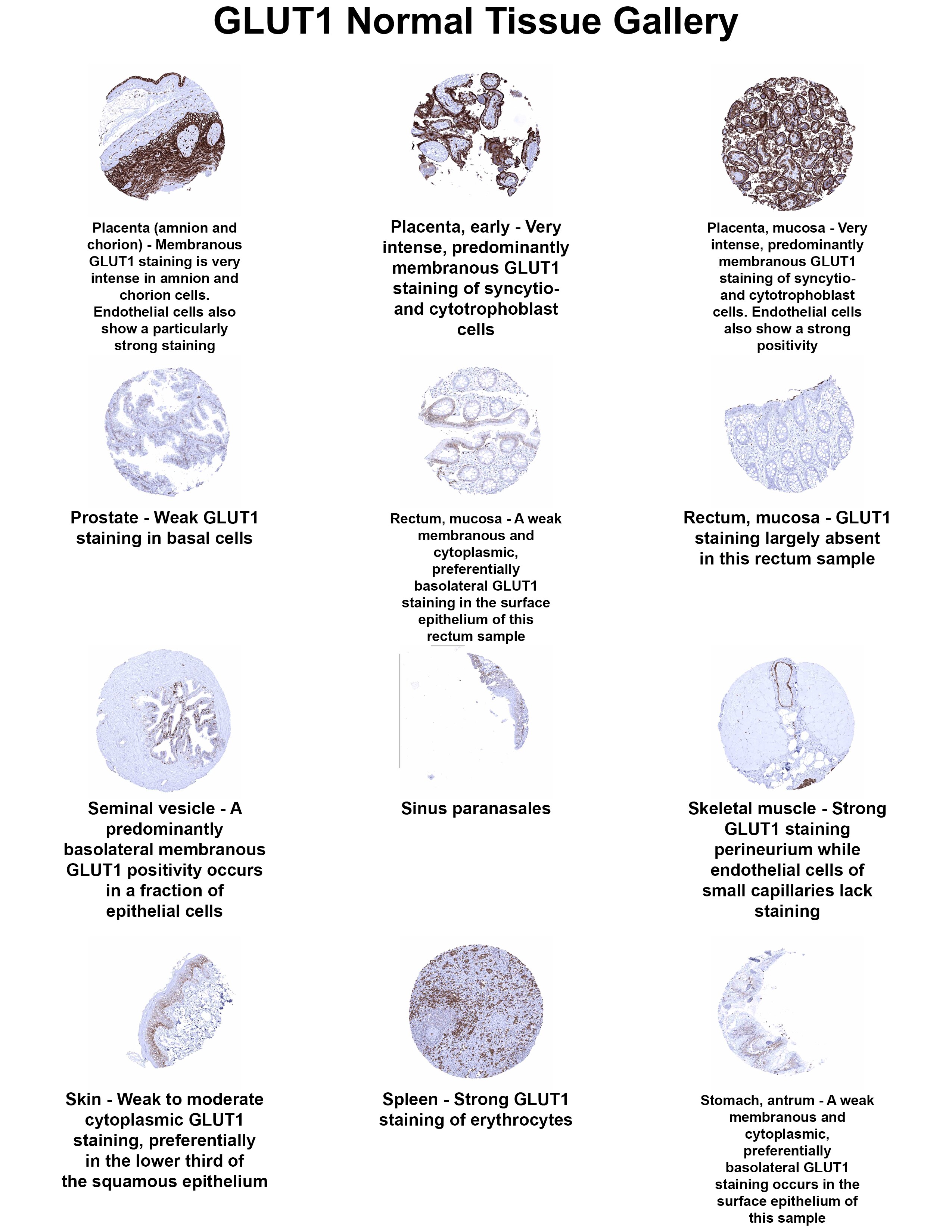 Glut1 Antibody (MSVA-401R) Glut1 Antibody (MSVA-401R) Glut1 Normal Tissue Gallery