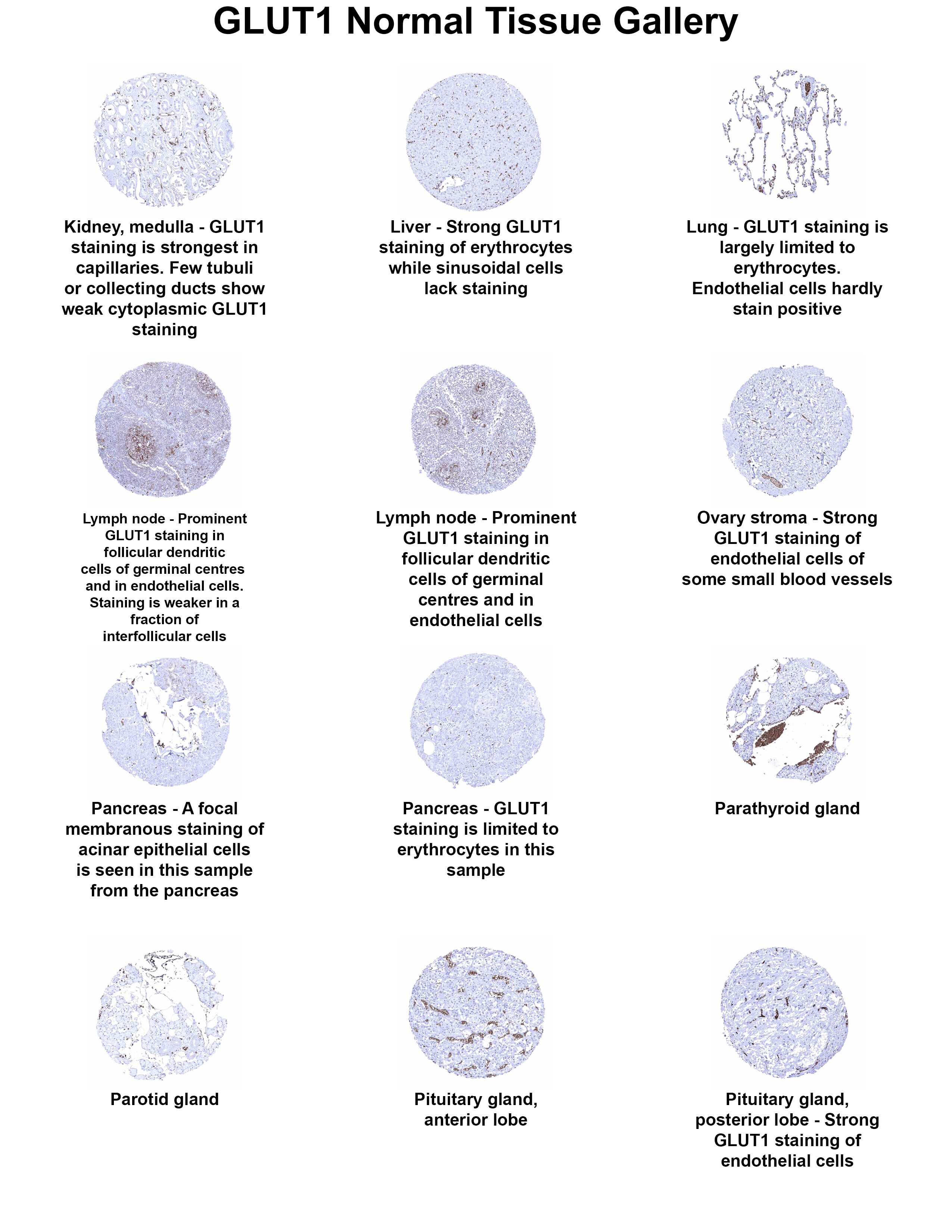 Glut1 Antibody (MSVA-401R) Glut1 Antibody (MSVA-401R) Glut1 Normal Tissue Gallery