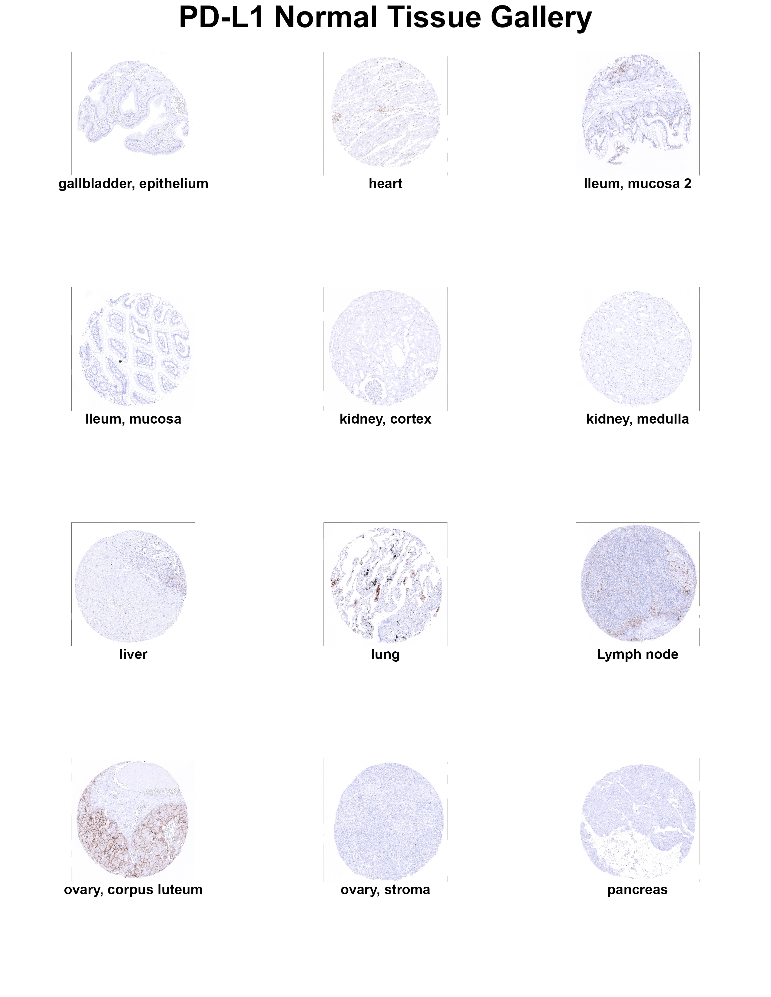 PD-L1 Antibody (MSVA-711R) PD-L1 Antibody (MSVA-711R) PD-L1 Normal Tissue Gallery