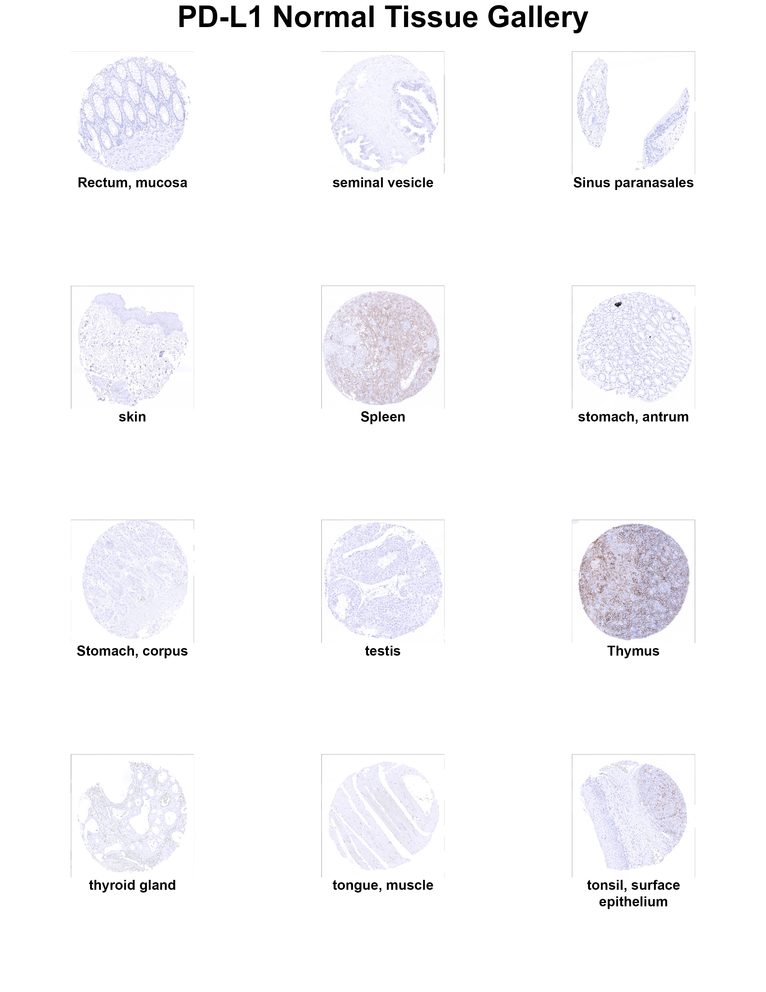 PD-L1 Antibody (MSVA-711R) PD-L1 Antibody (MSVA-711R) PD-L1 Normal Tissue Gallery