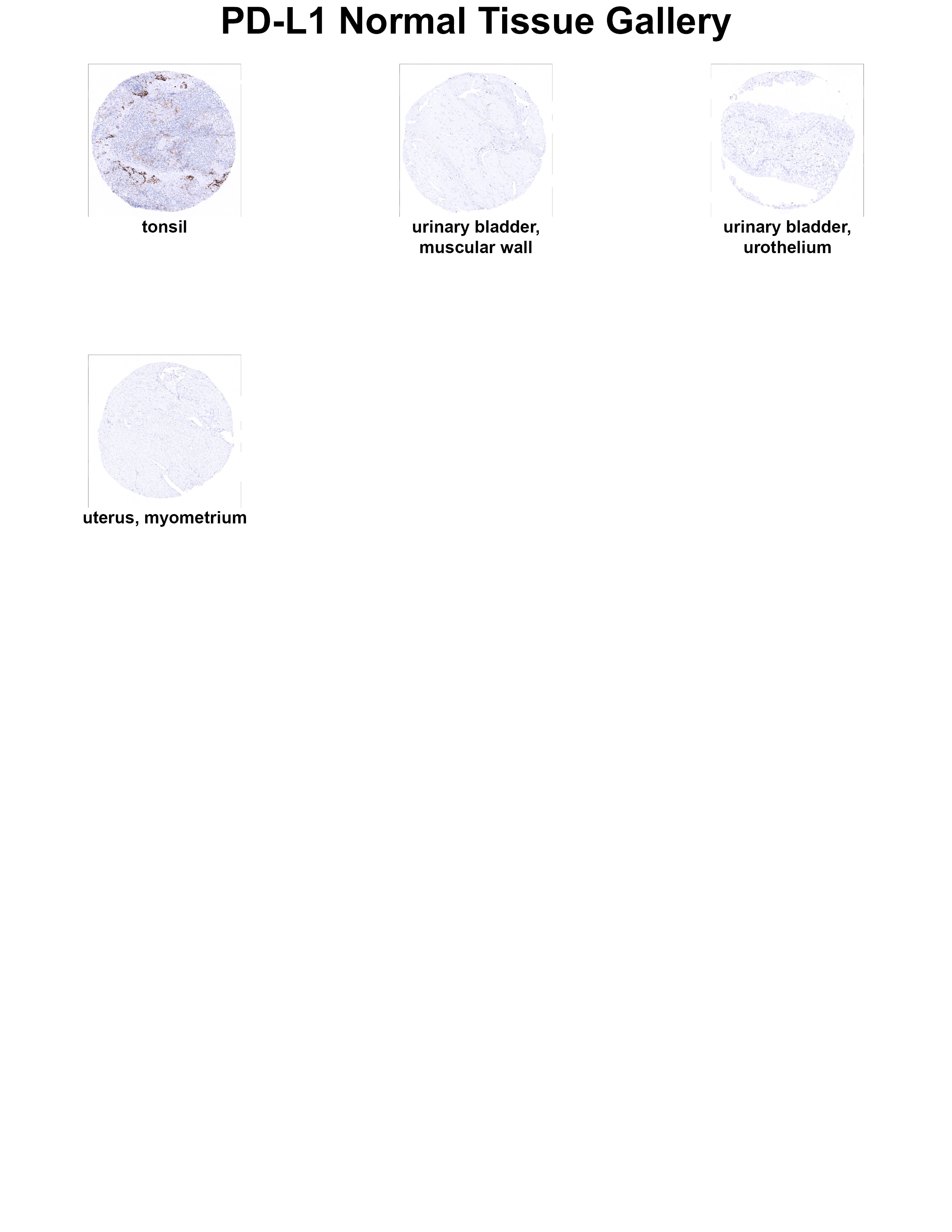 PD-L1 Antibody (MSVA-711R) PD-L1 Antibody (MSVA-711R) PD-L1 Normal Tissue Gallery