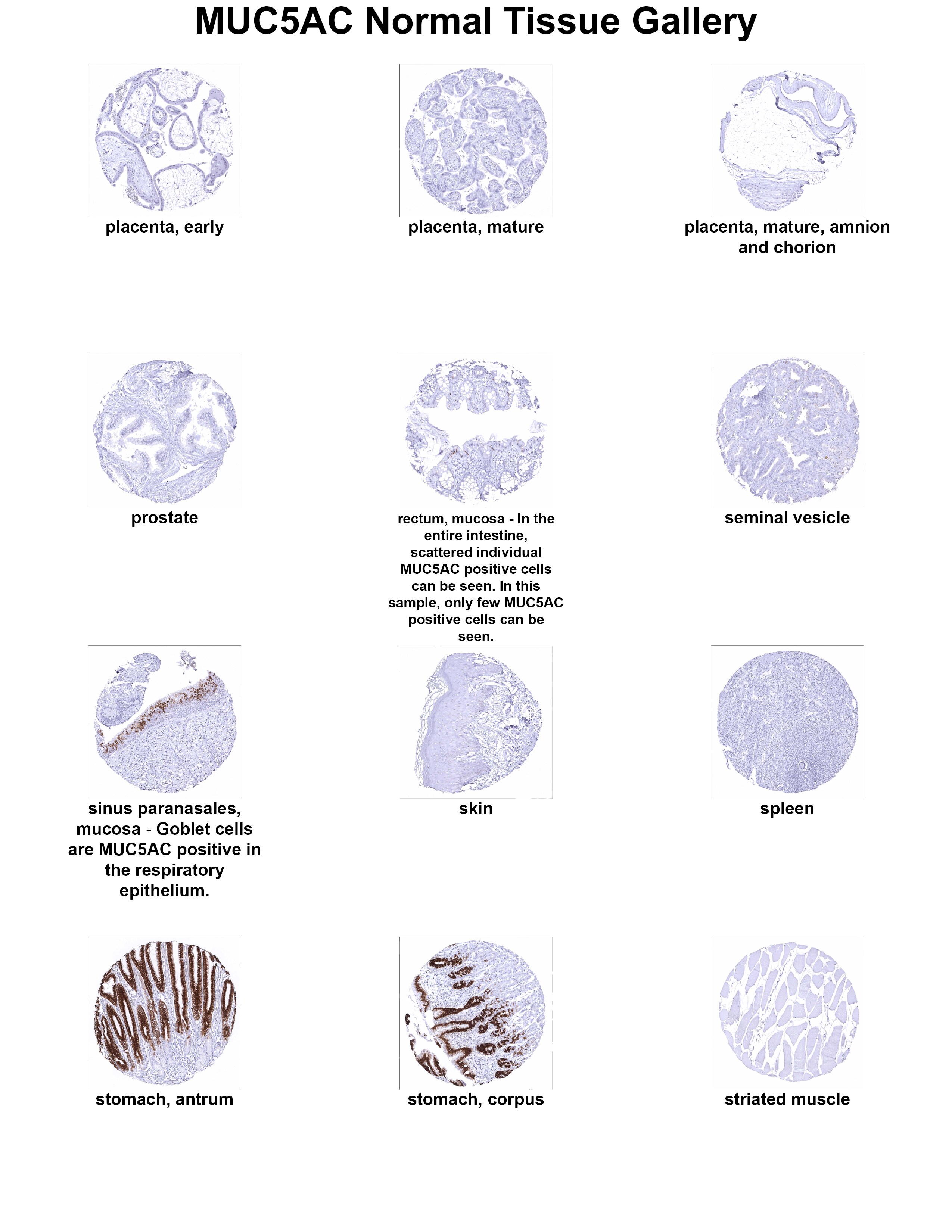 MUC5AC Antibody (MSVA-109M) MUC5AC Antibody (MSVA-109M) MUC5AC Normal Tissue Gallery