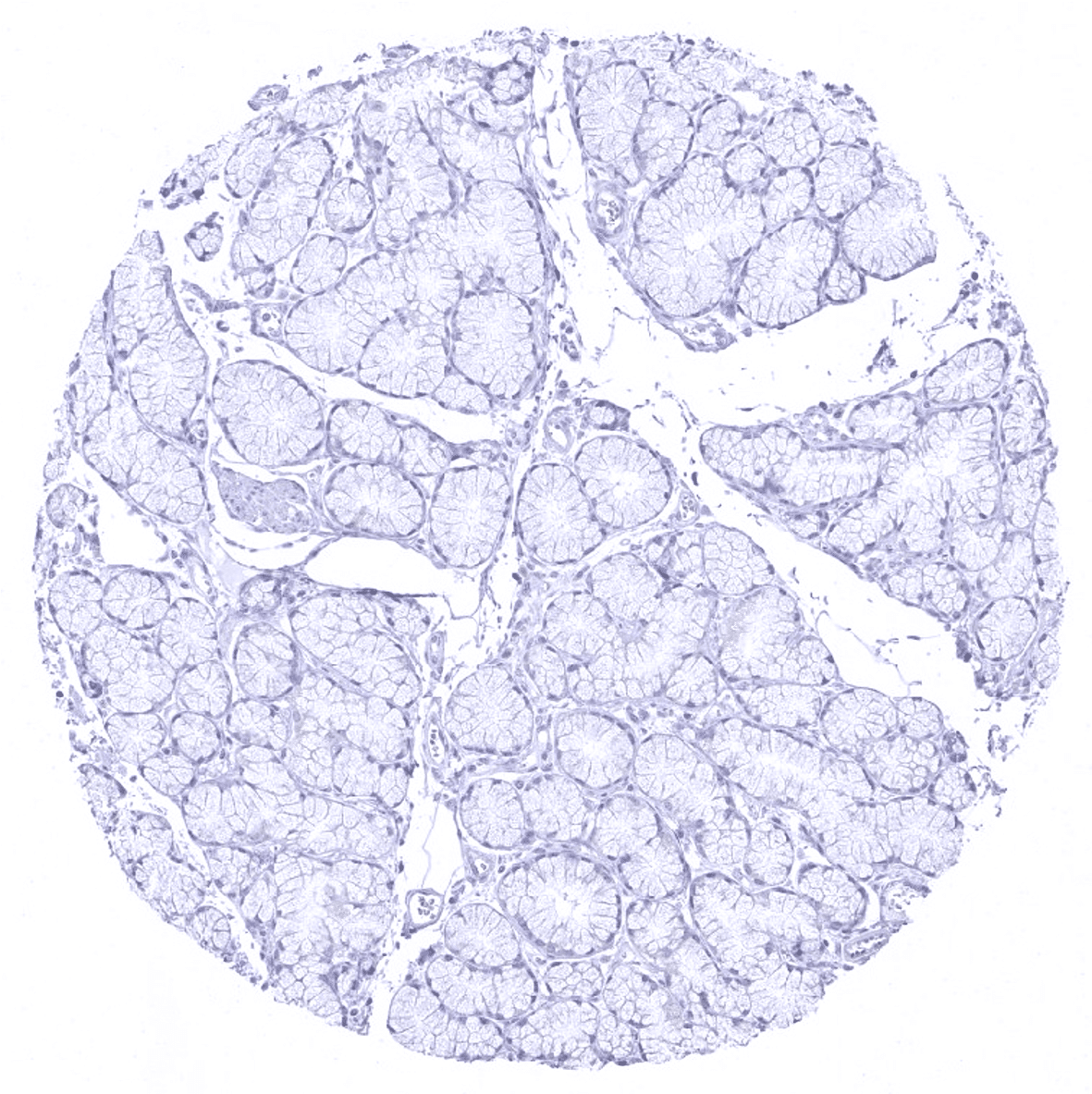 MUC5AC Antibody (MSVA-109M)