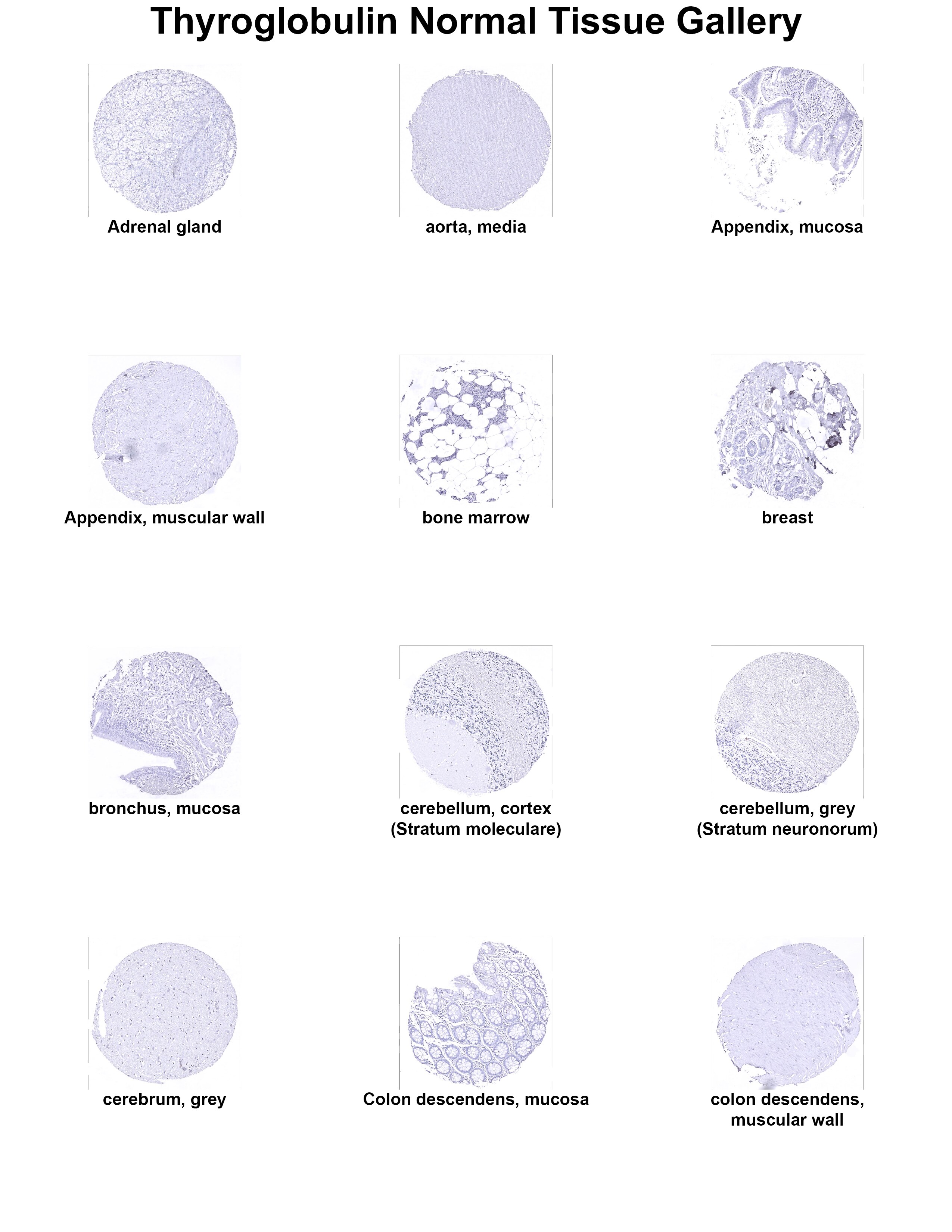 Thyroglobulin Antibody (MSVA-189R) Thyroglobulin Antibody (MSVA-189R) Thyroglobulin Normal Tissue Gallery