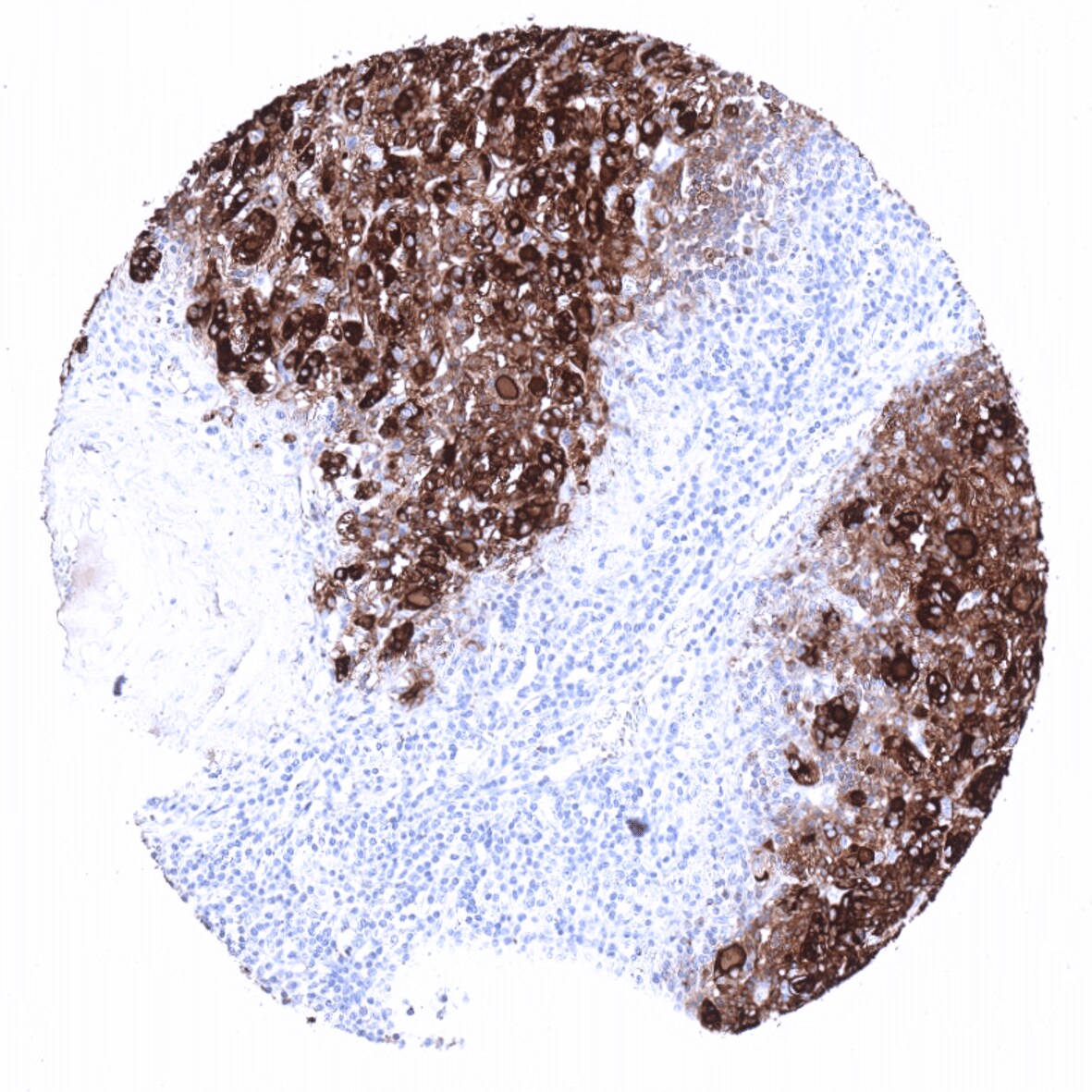 Thyroglobulin Antibody (MSVA-189R)