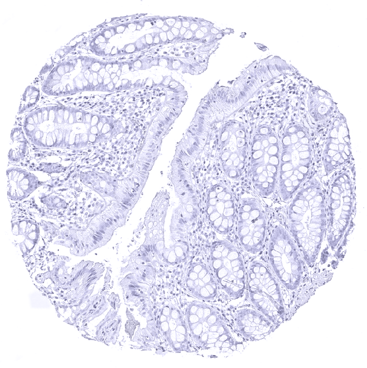 Thyroglobulin Antibody (MSVA-189R)