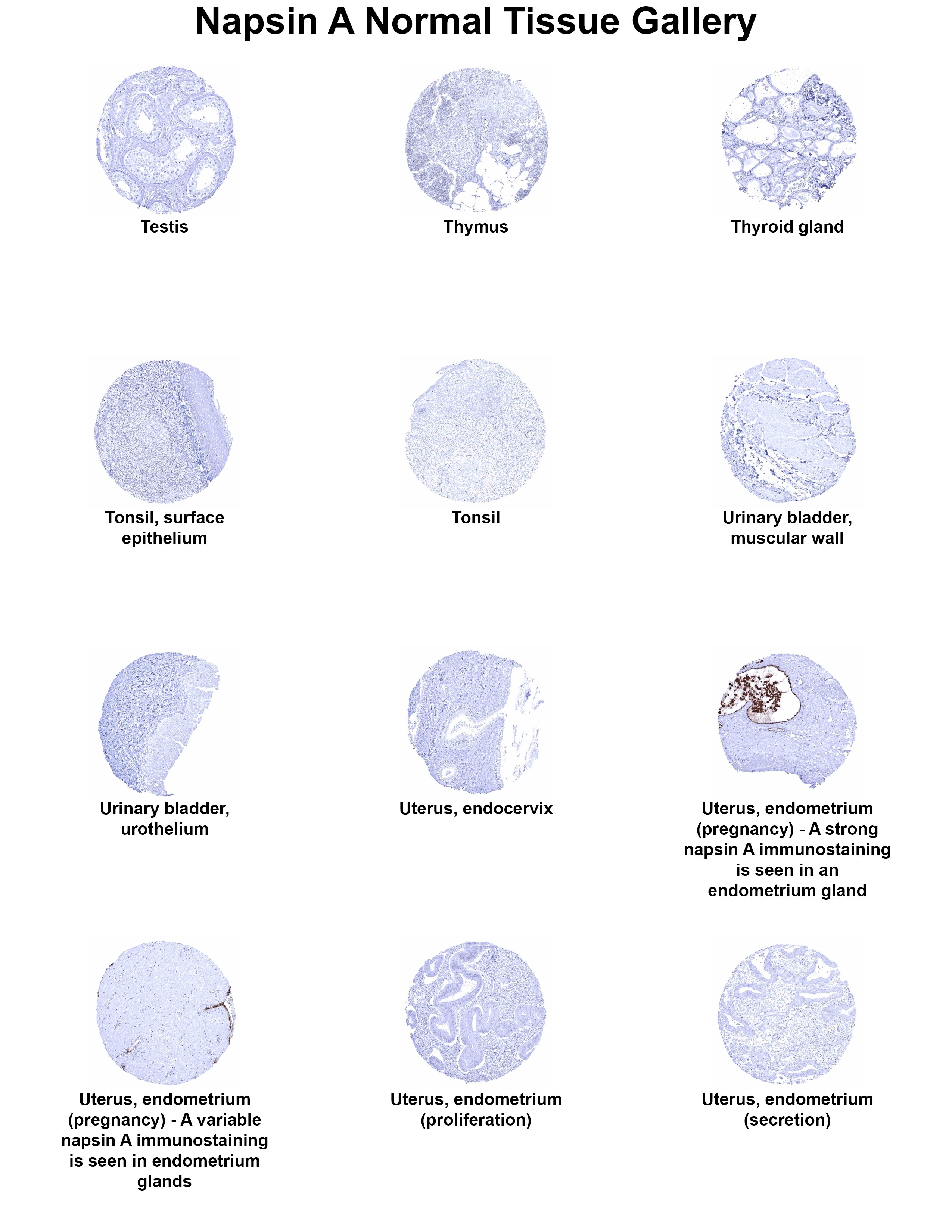 Napsin A Antibody (MSVA-112R) Napsin A Antibody (MSVA-112R) Napsin A Normal Tissue Gallery