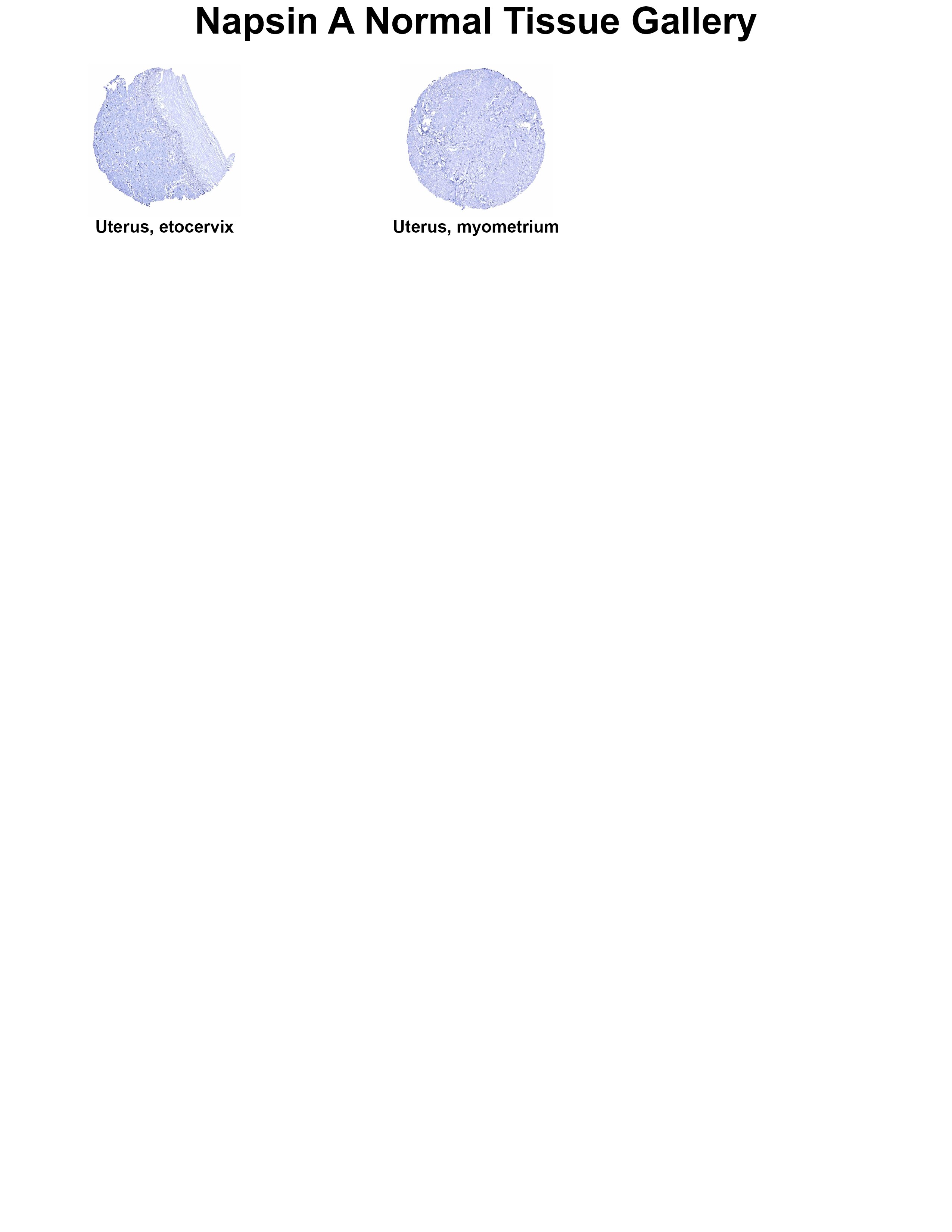 Napsin A Antibody (MSVA-112R) Napsin A Antibody (MSVA-112R) Napsin A Normal Tissue Gallery
