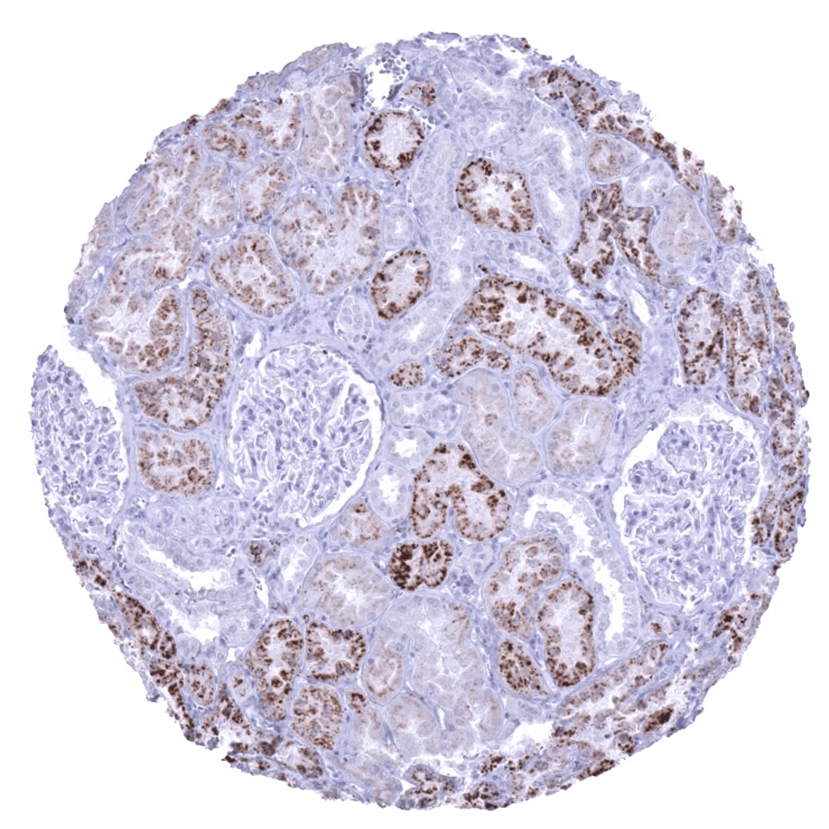 Napsin A Antibody (MSVA-112R)