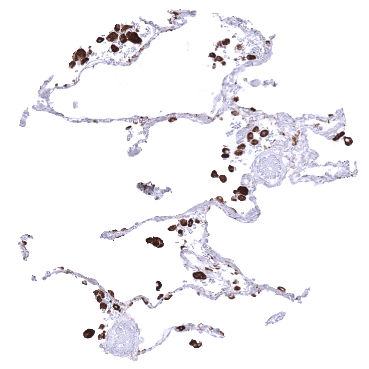 Napsin A Antibody (MSVA-112R)