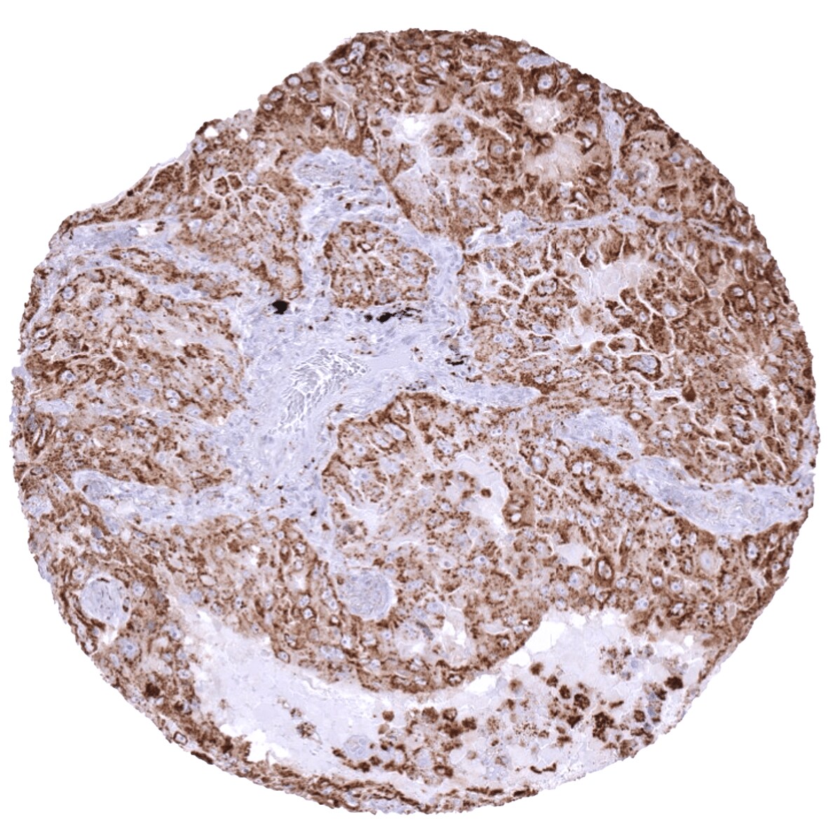 Napsin A Antibody (MSVA-112R)