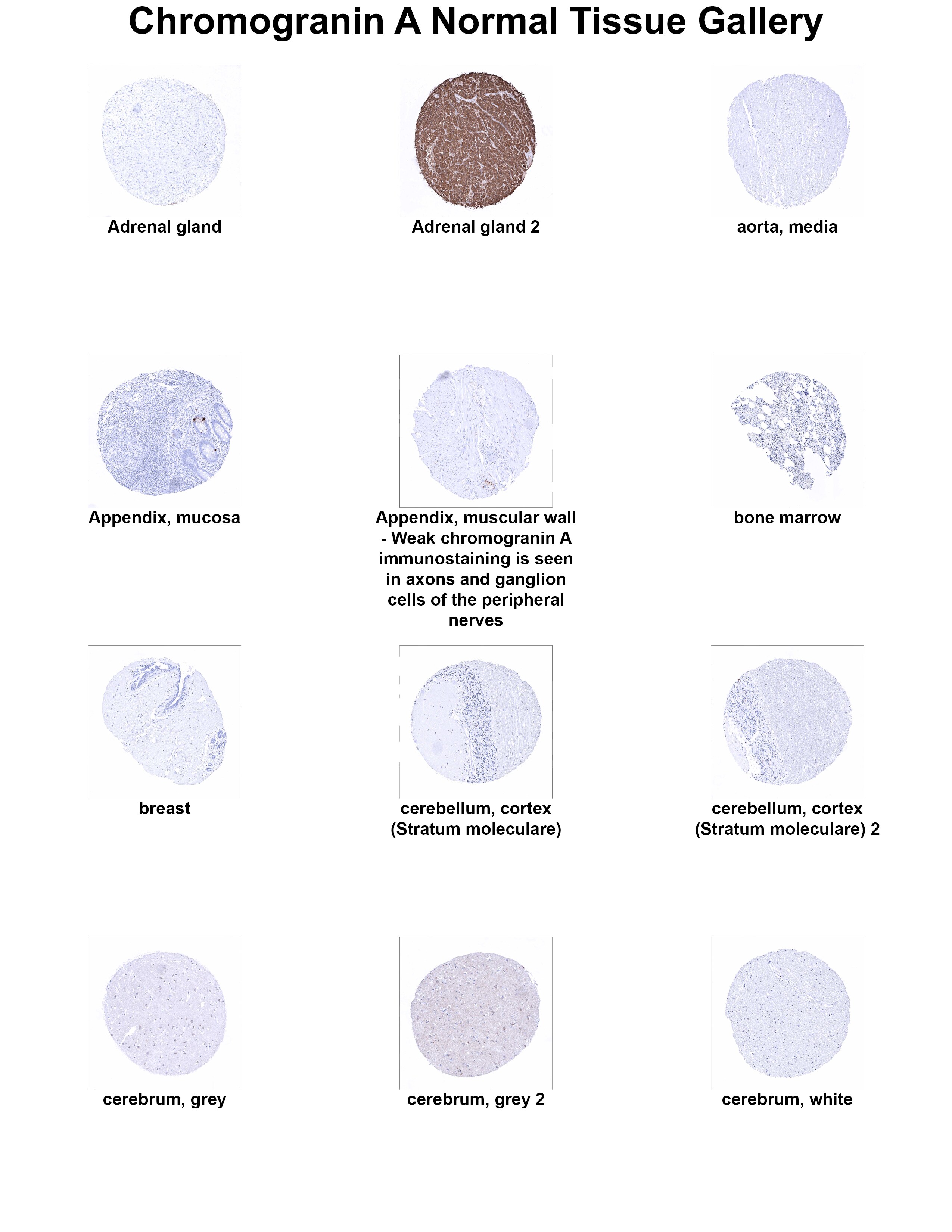 Chromogranin A Antibody (MSVA-380R) Chromogranin A Antibody (MSVA-380R) Chromogranin A Normal Tissue Gallery