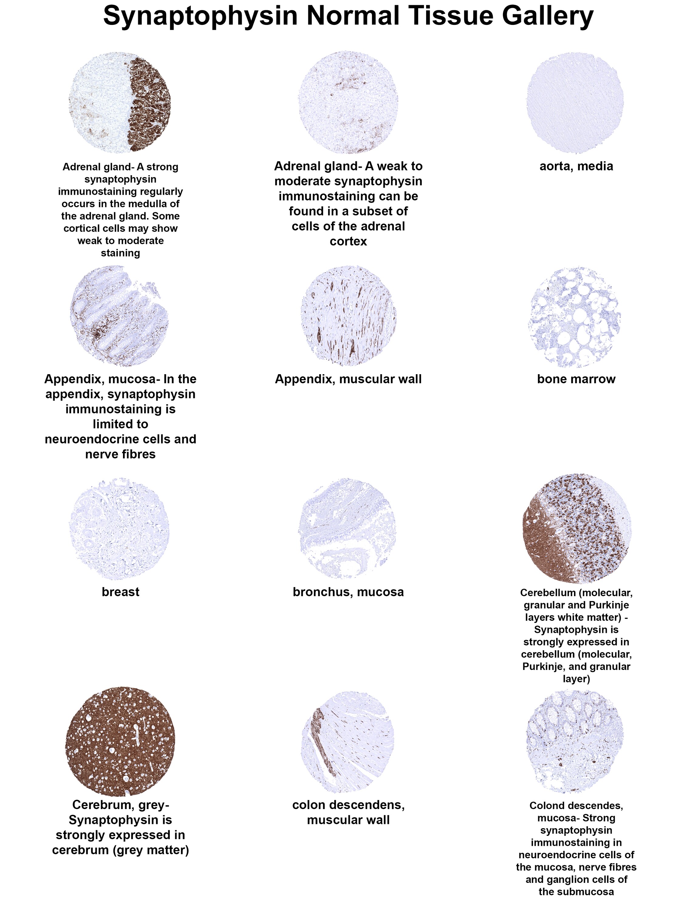 Synaptophysin Antibody (MSVA-462R) Synaptophysin Antibody (MSVA-462R) Synaptophysin Normal Tissue Gallery