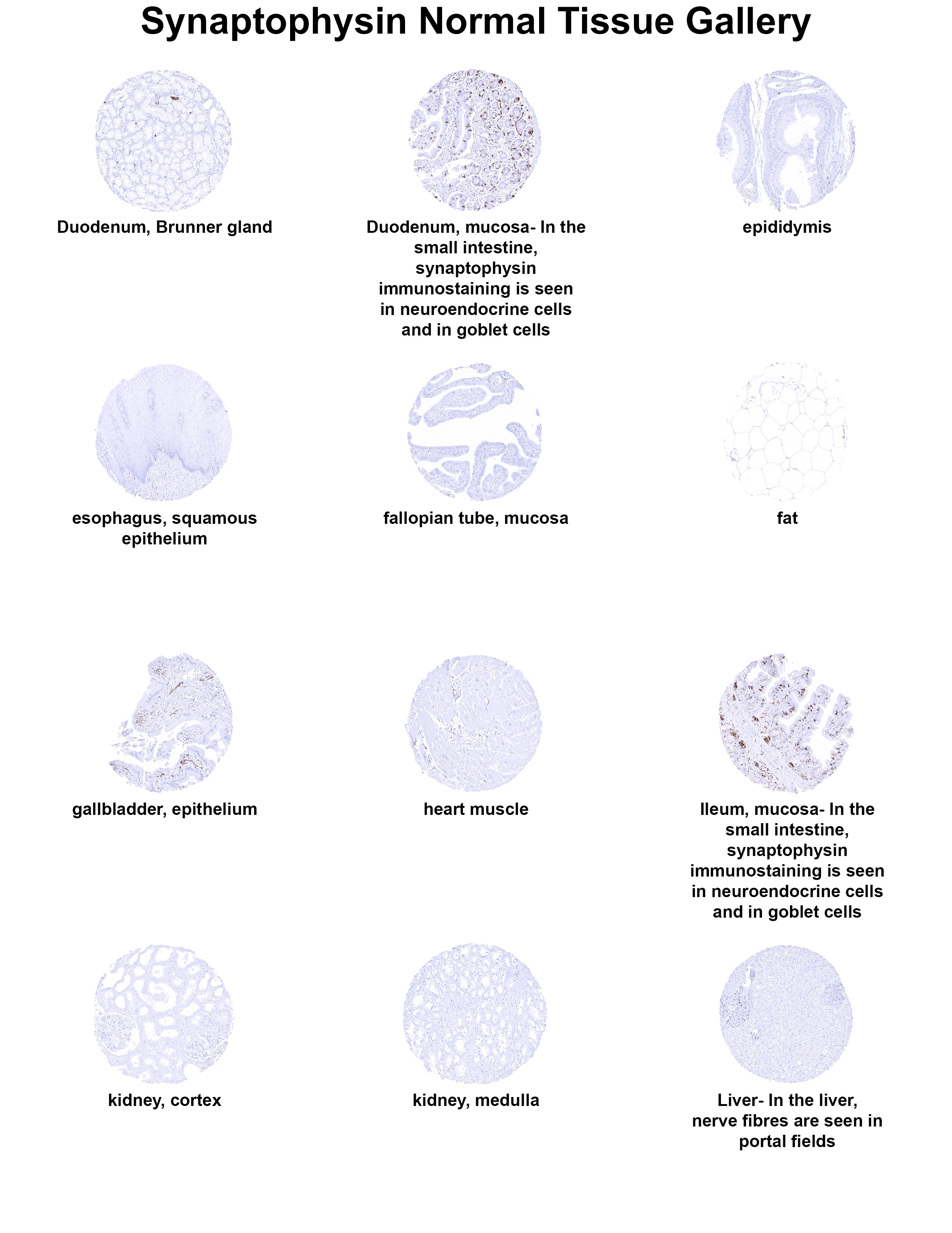 Synaptophysin Antibody (MSVA-462R) Synaptophysin Antibody (MSVA-462R) Synaptophysin Normal Tissue Gallery