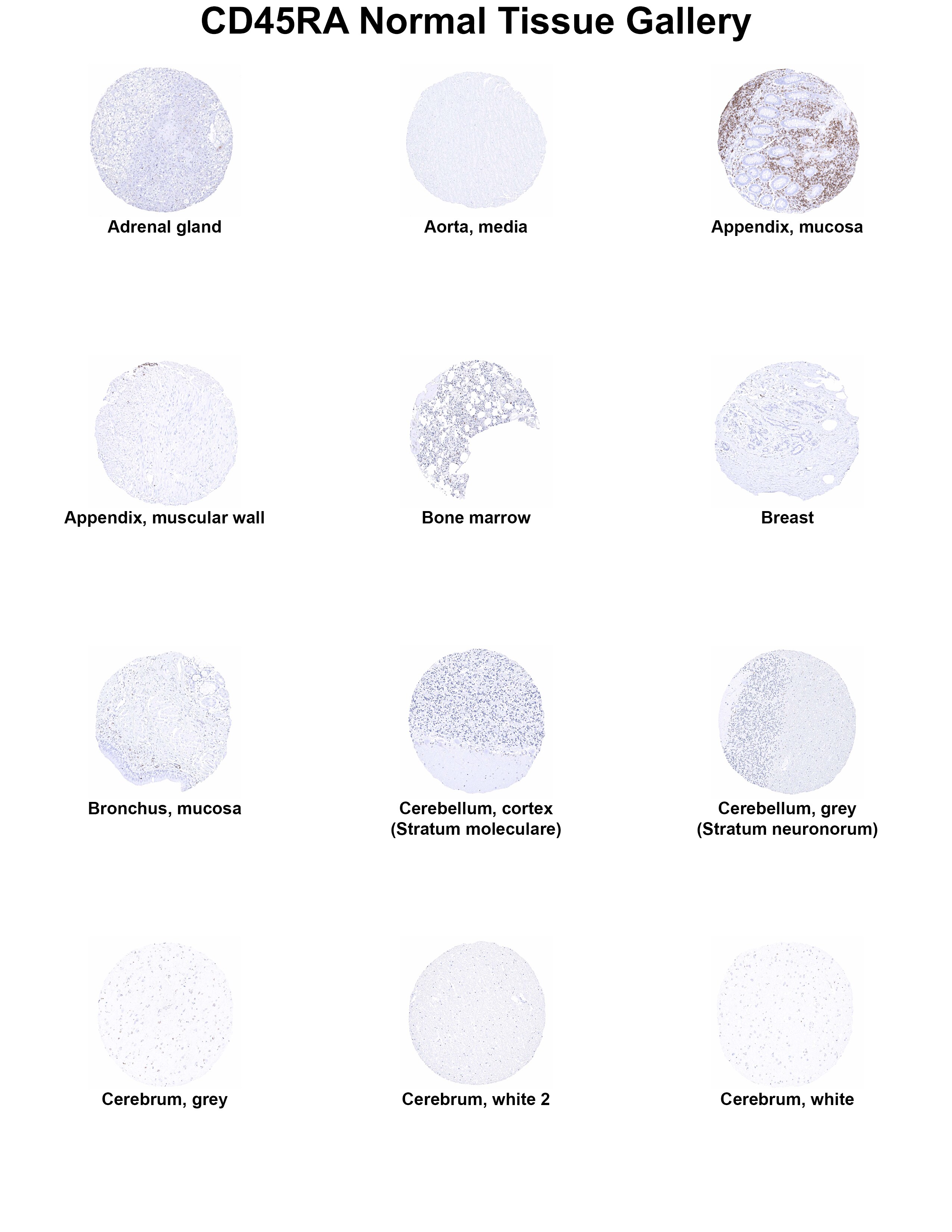 CD45RA Antibody (MSVA-472M) CD45RA Antibody (MSVA-472M) CD45RA Normal Tissue Gallery