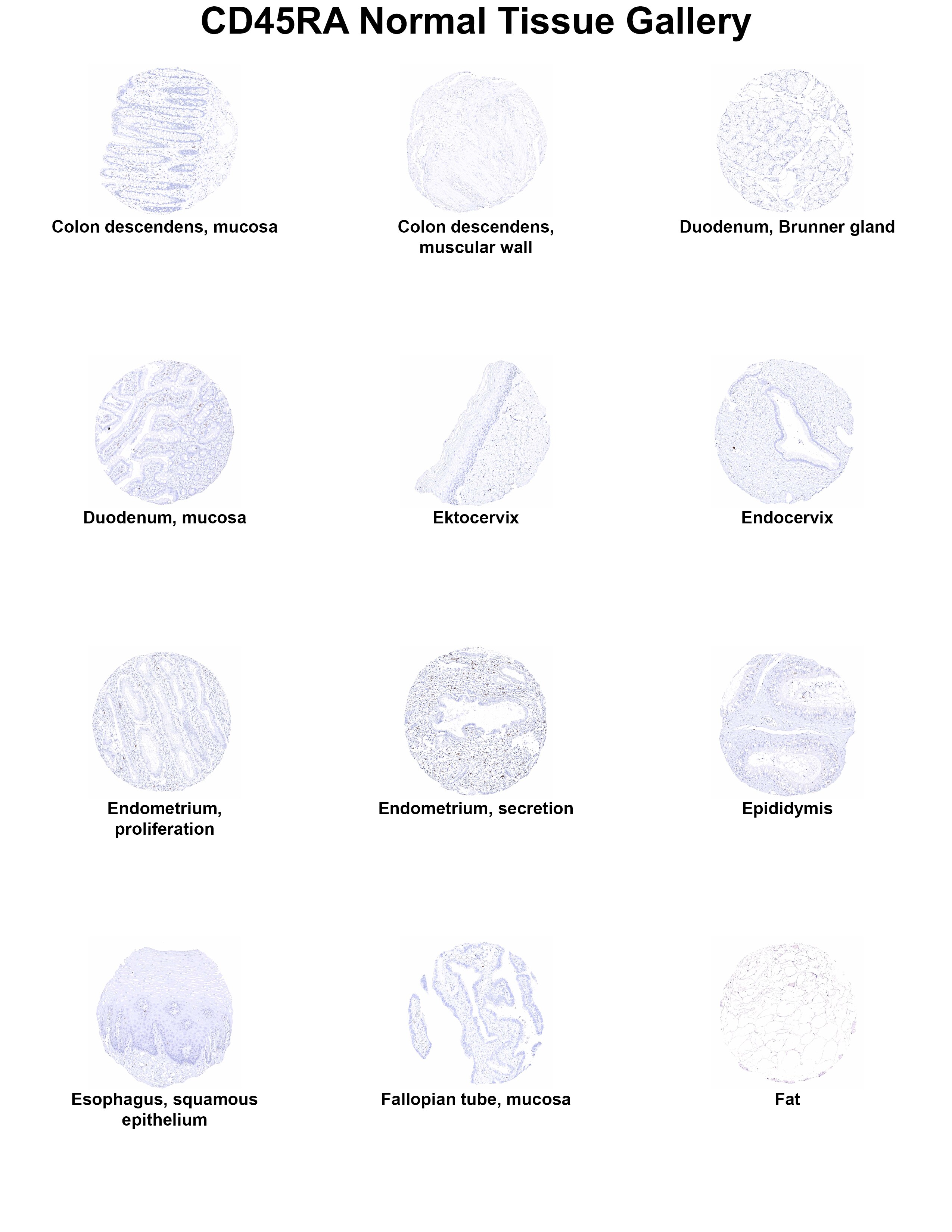 CD45RA Antibody (MSVA-472M) CD45RA Antibody (MSVA-472M) CD45RA Normal Tissue Gallery