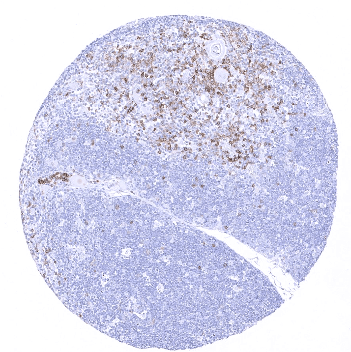 CD45RA Antibody (MSVA-472M)