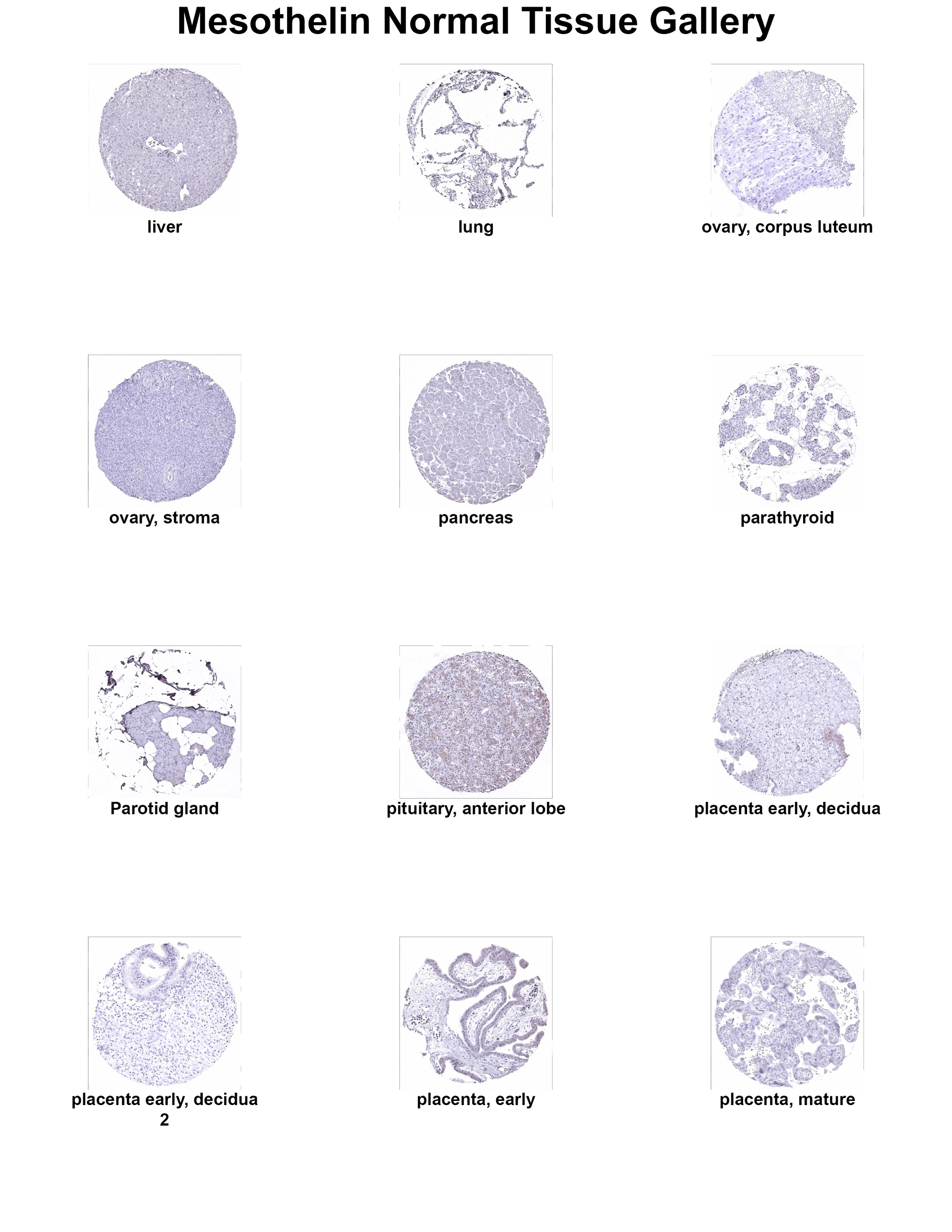 Mesothelin Antibody (MSVA-235M) Mesothelin Antibody (MSVA-235M) Mesothelin Normal Tissue Gallery