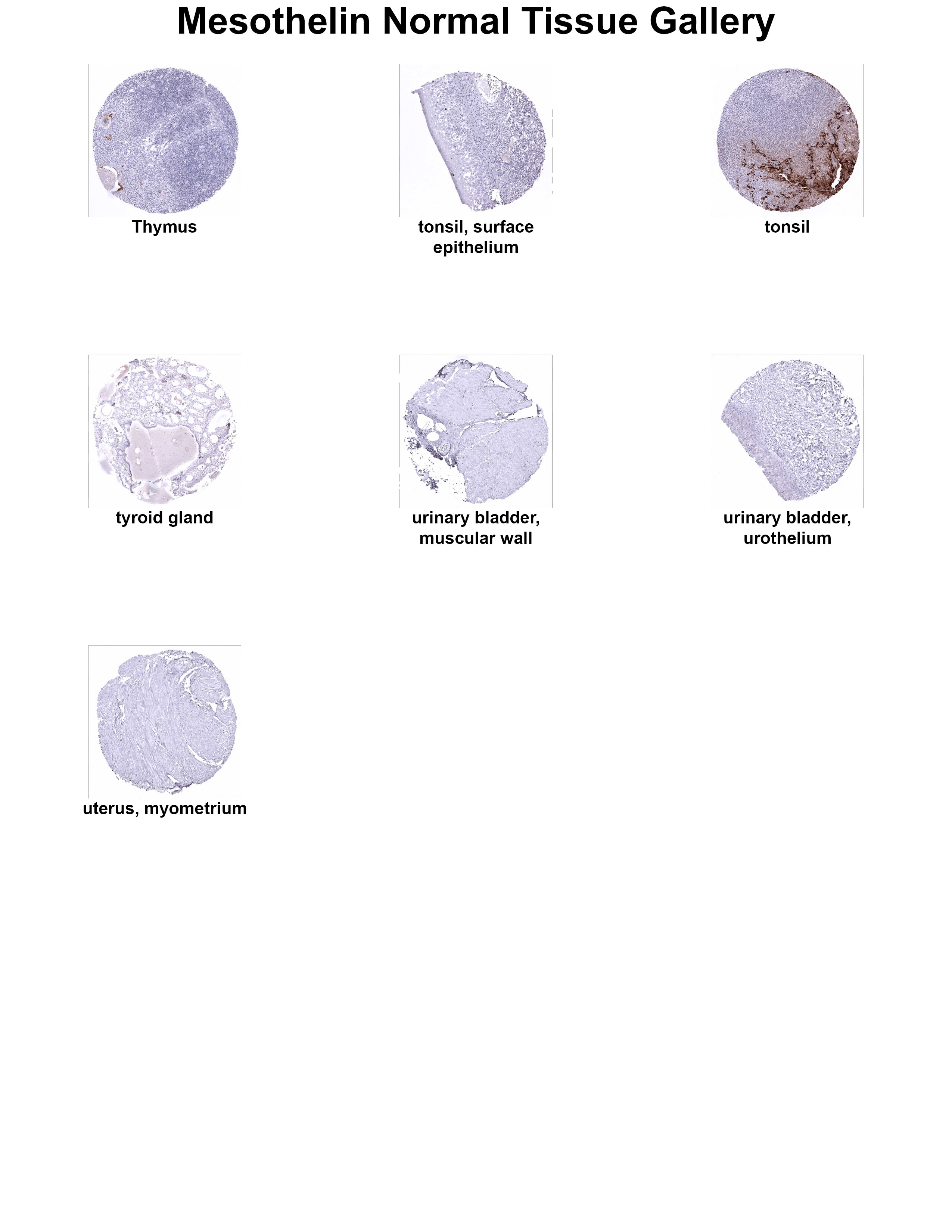 Mesothelin Antibody (MSVA-235M) Mesothelin Antibody (MSVA-235M) Mesothelin Normal Tissue Gallery