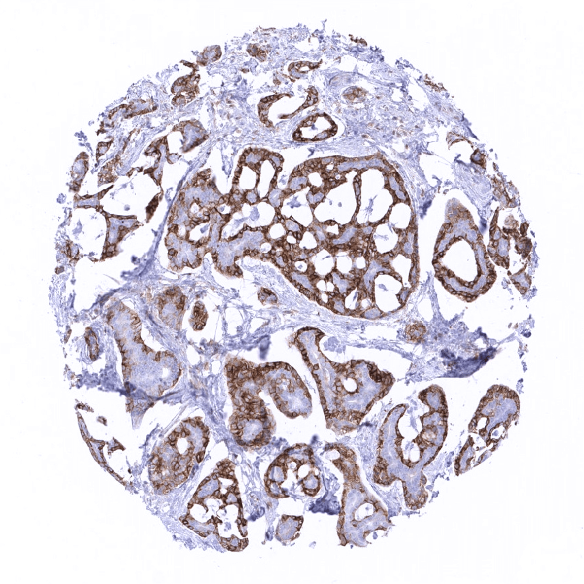 Mesothelin Antibody (MSVA-235M)