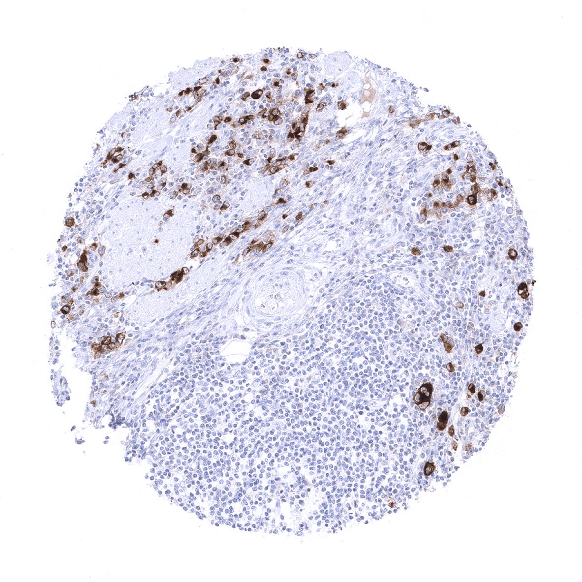 Mesothelin Antibody (MSVA-235M)