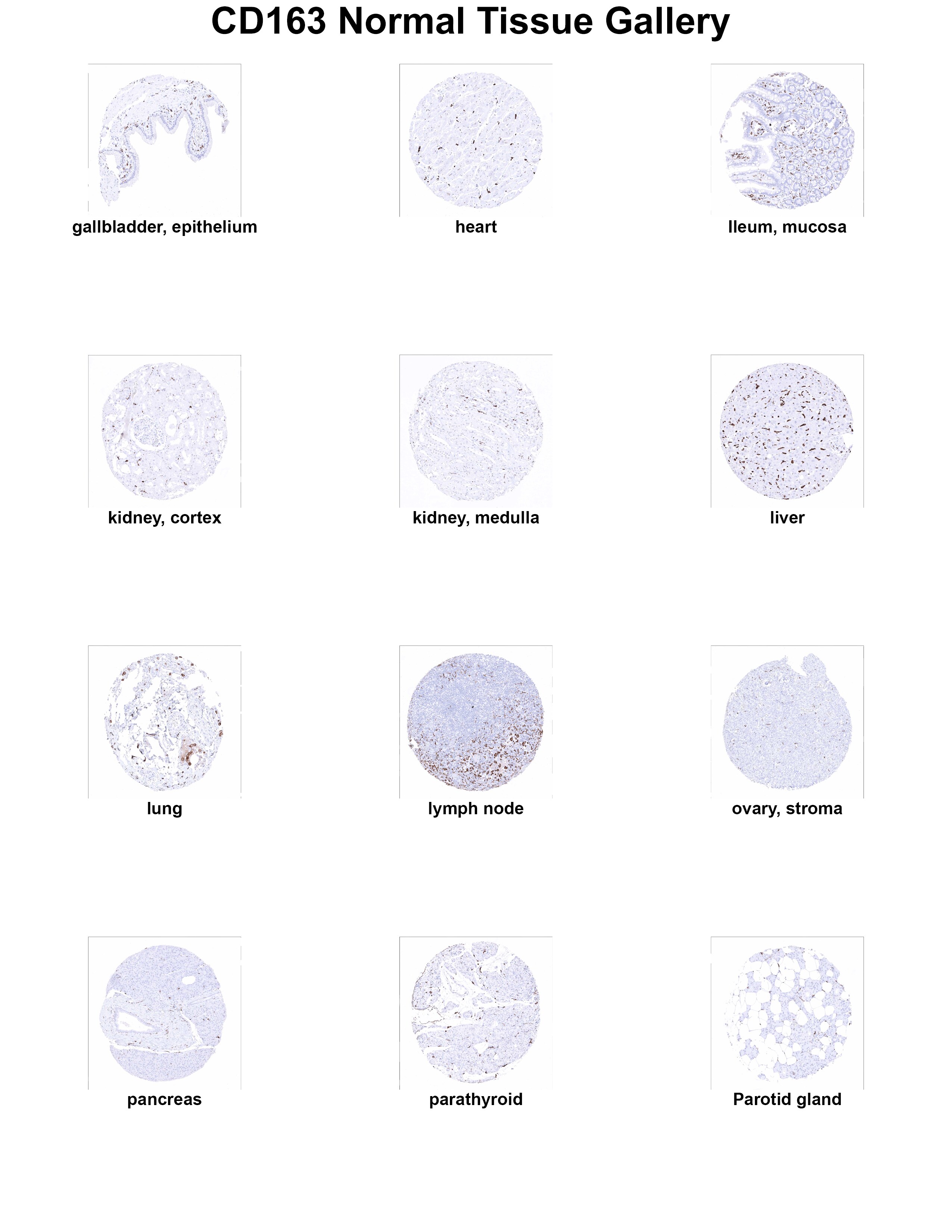 CD163 Antibody (MSVA-163M) CD163 Antibody (MSVA-163M) CD163 Normal Tissue Gallery