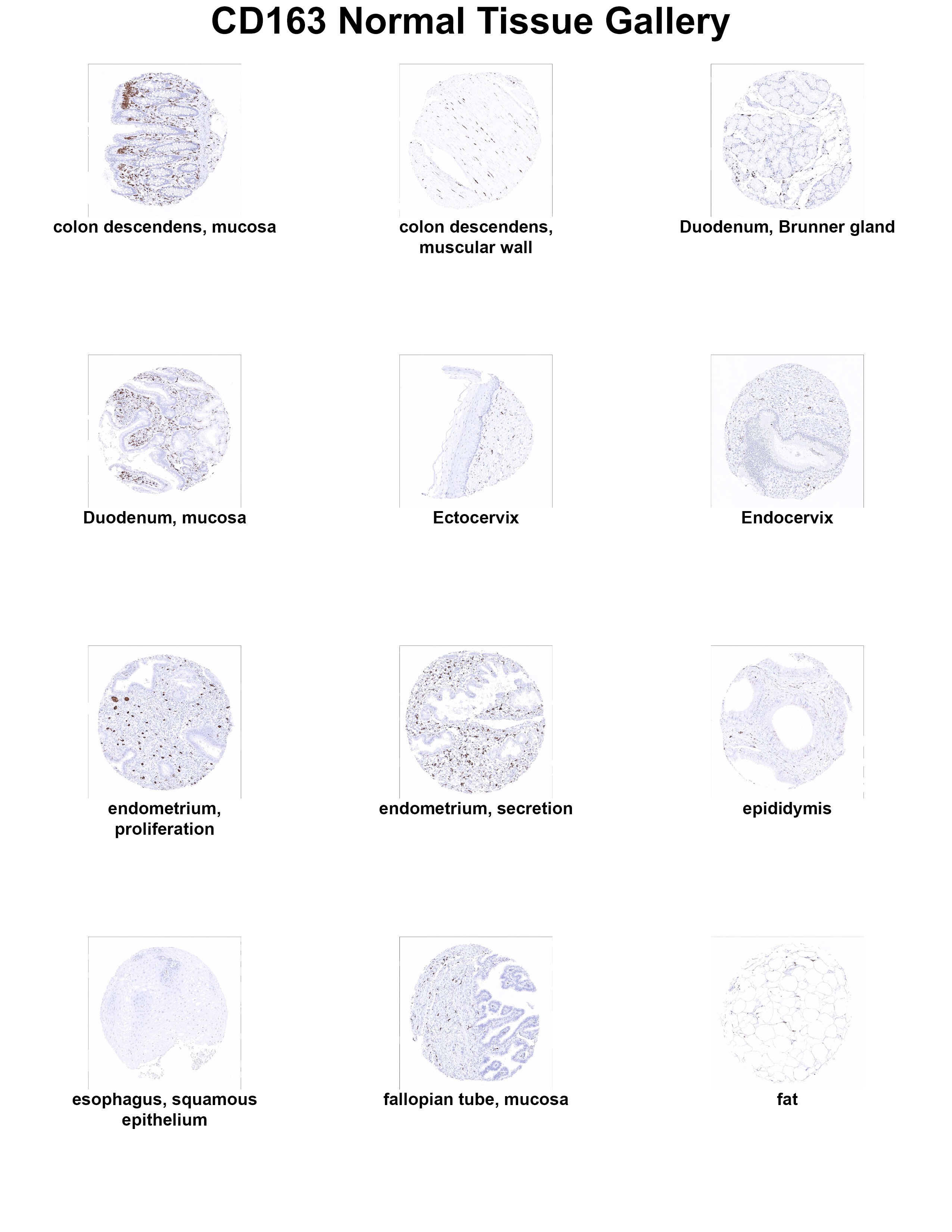CD163 Antibody (MSVA-163M) CD163 Antibody (MSVA-163M) CD163 Normal Tissue Gallery