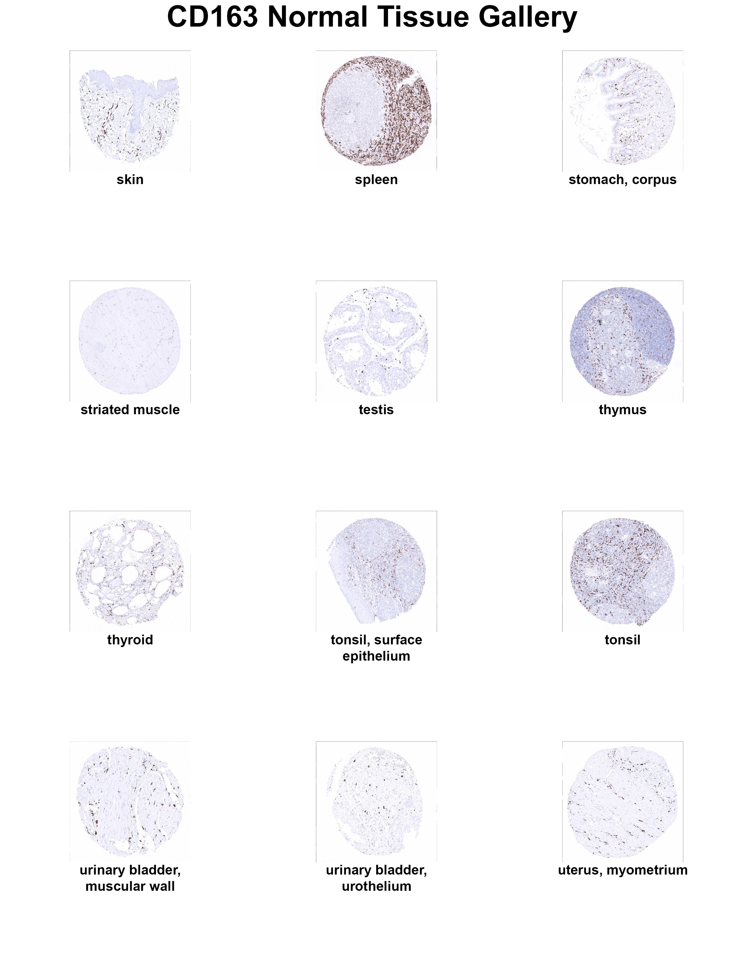CD163 Antibody (MSVA-163M) CD163 Antibody (MSVA-163M) CD163 Normal Tissue Gallery