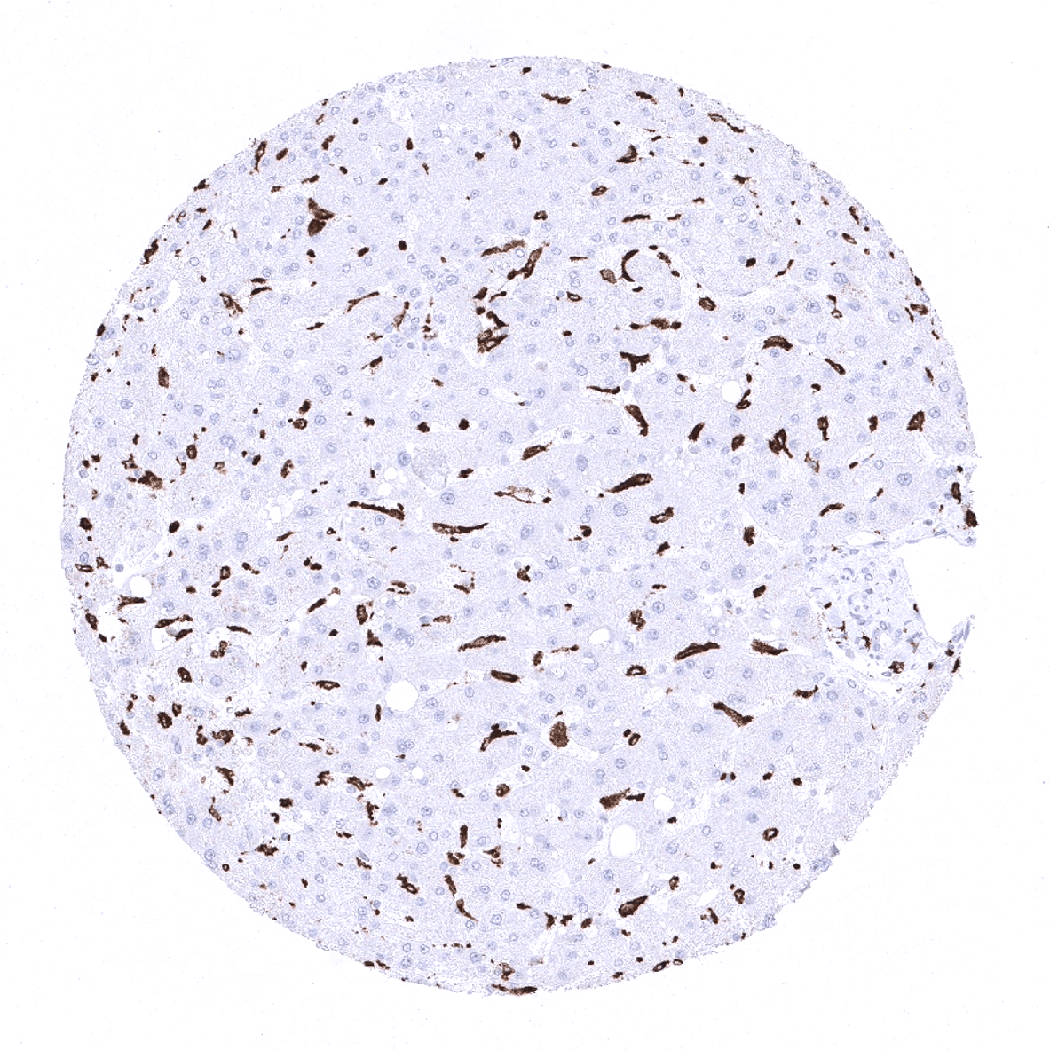 CD163 Antibody (MSVA-163M)