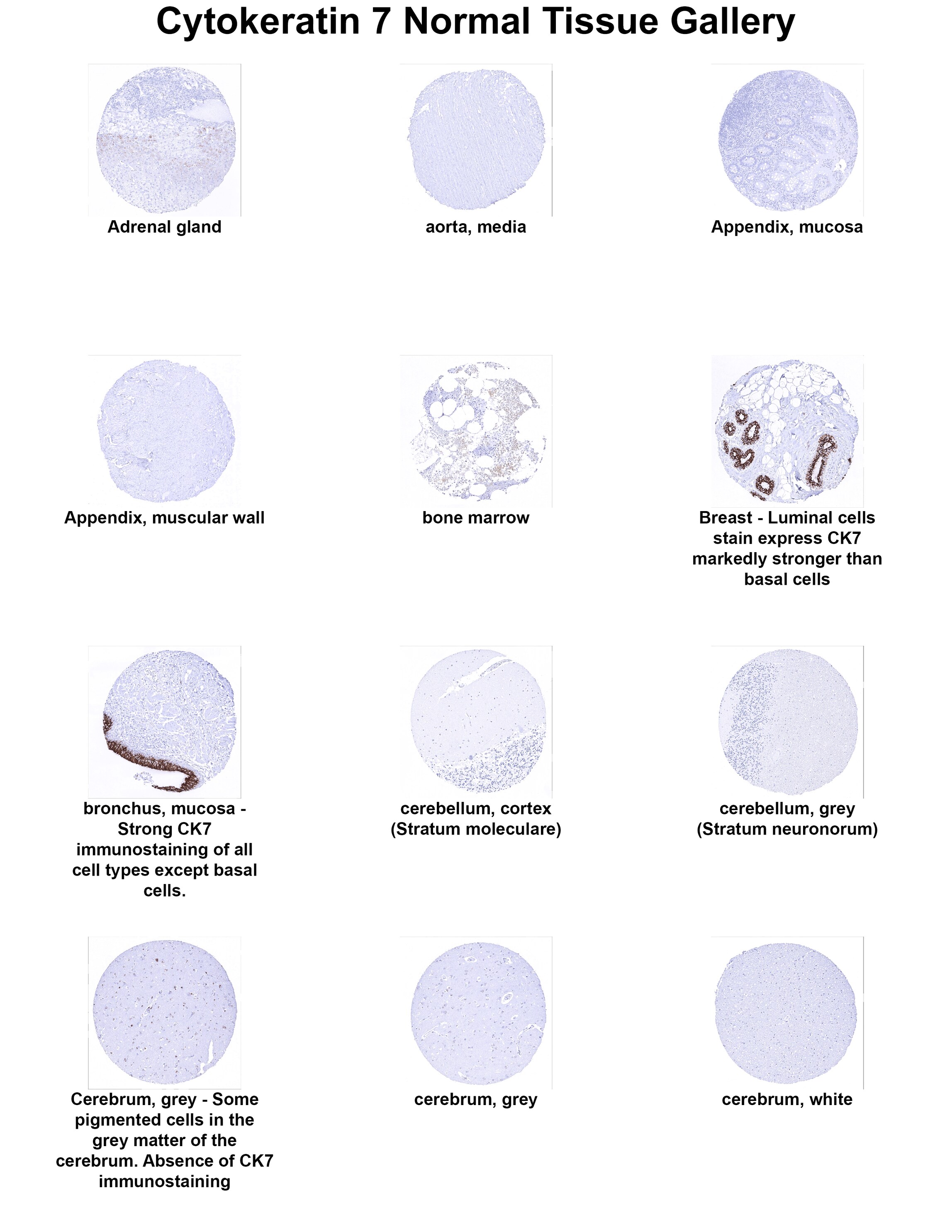 Cytokeratin 7 Antibody (MSVA-607R) Cytokeratin 7 Antibody (MSVA-607R) Cytokeratin 7 Normal Tissue Gallery