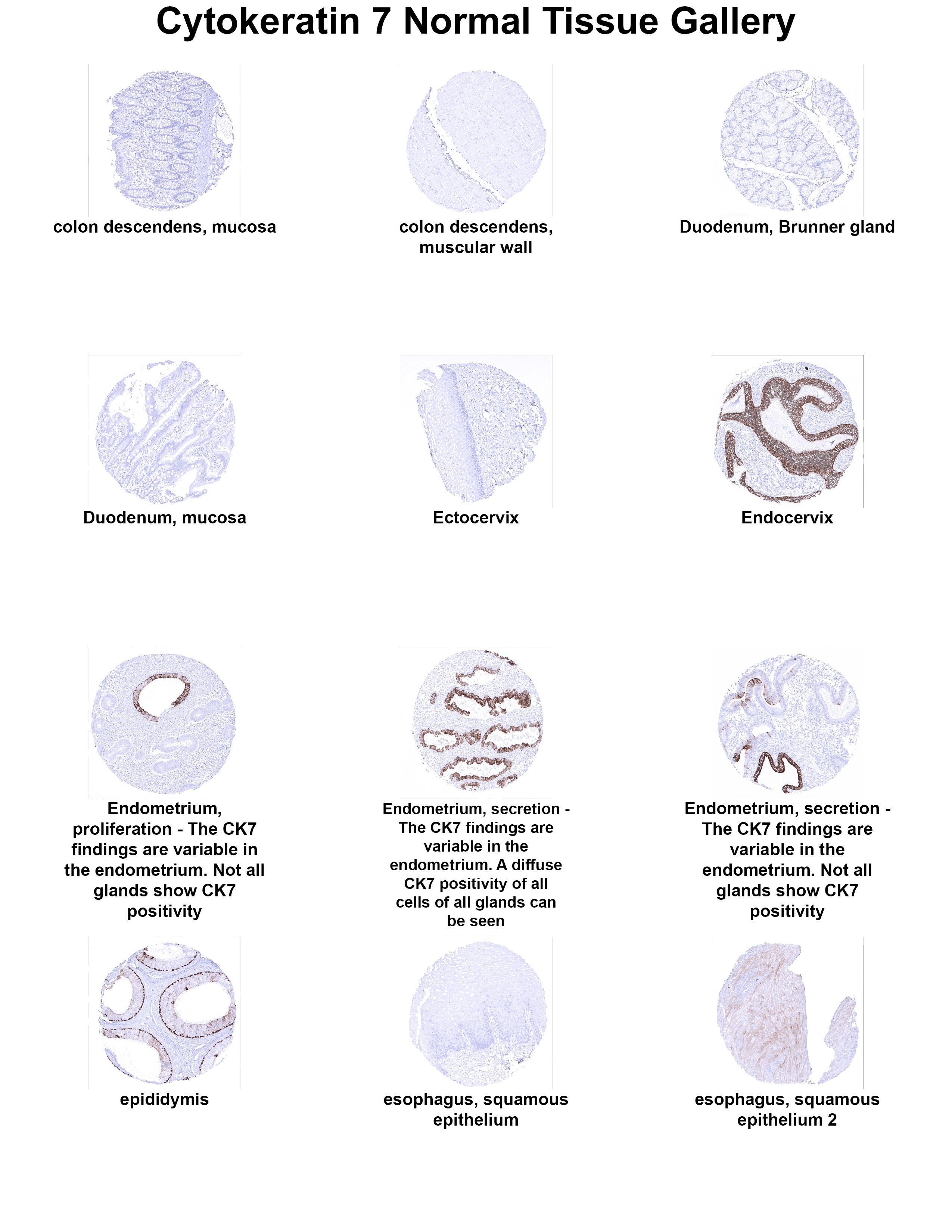 Cytokeratin 7 Antibody (MSVA-607R) Cytokeratin 7 Antibody (MSVA-607R) Cytokeratin 7 Normal Tissue Gallery