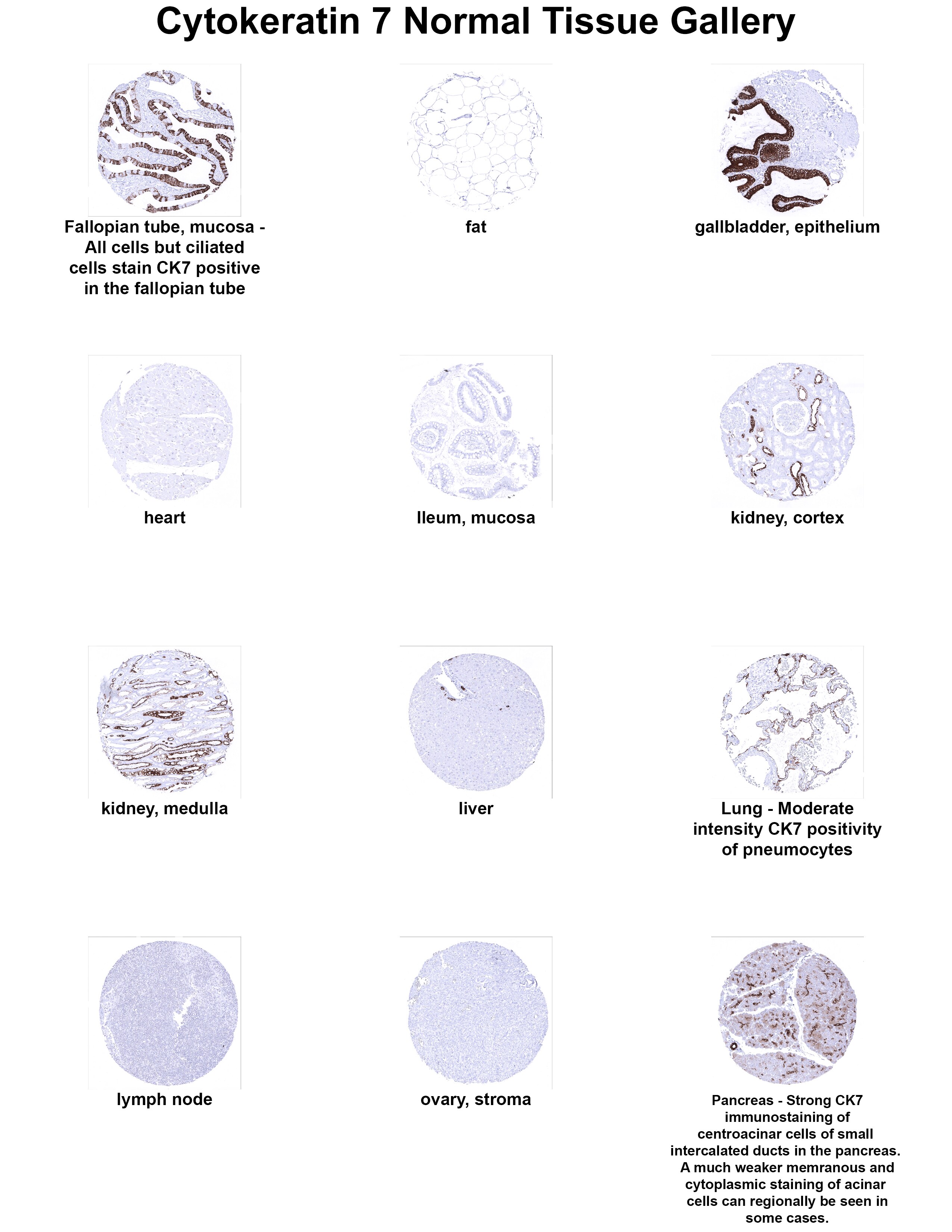 Cytokeratin 7 Antibody (MSVA-607R) Cytokeratin 7 Antibody (MSVA-607R) Cytokeratin 7 Normal Tissue Gallery