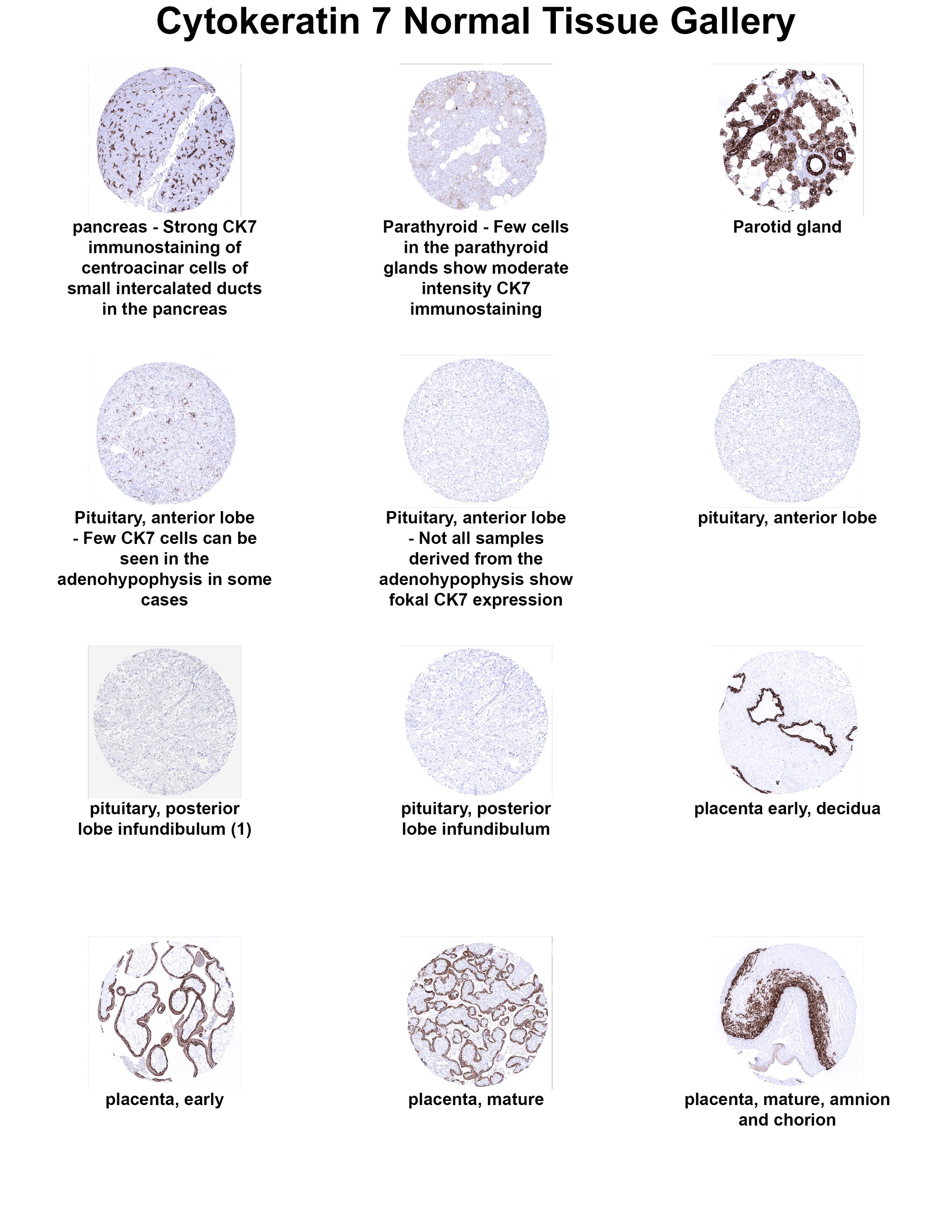 Cytokeratin 7 Antibody (MSVA-607R) Cytokeratin 7 Antibody (MSVA-607R) Cytokeratin 7 Normal Tissue Gallery
