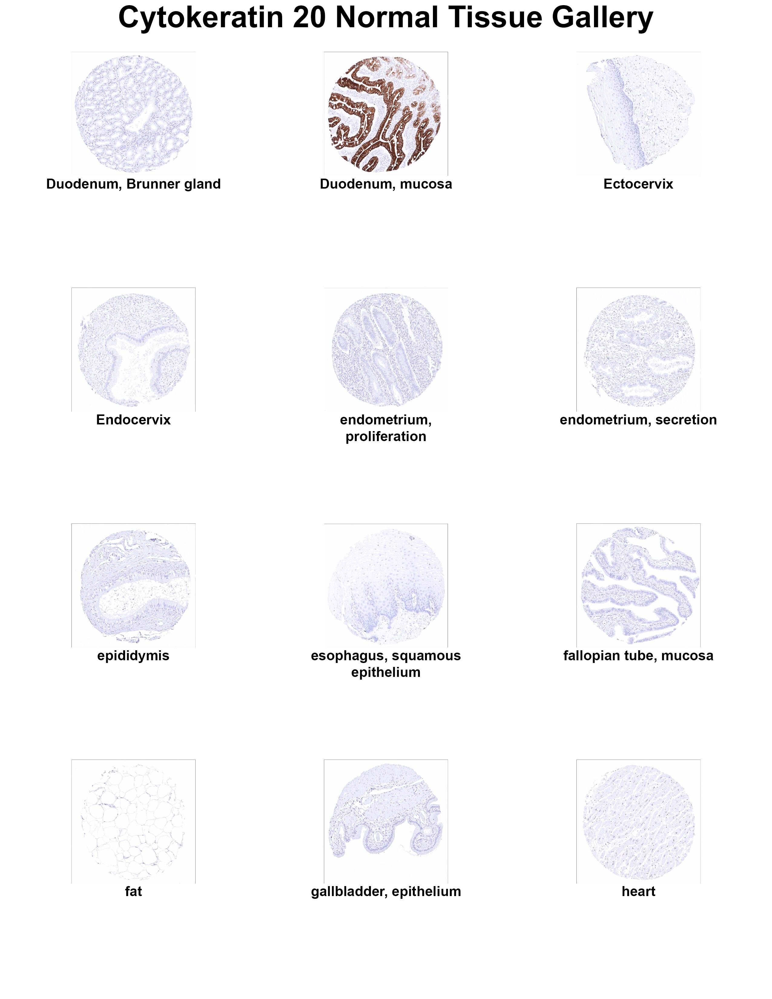 Cytokeratin 20 Antibody (MSVA-620R) Cytokeratin 20 Antibody (MSVA-620R) Cytokeratin 20 Normal Tissue Gallery