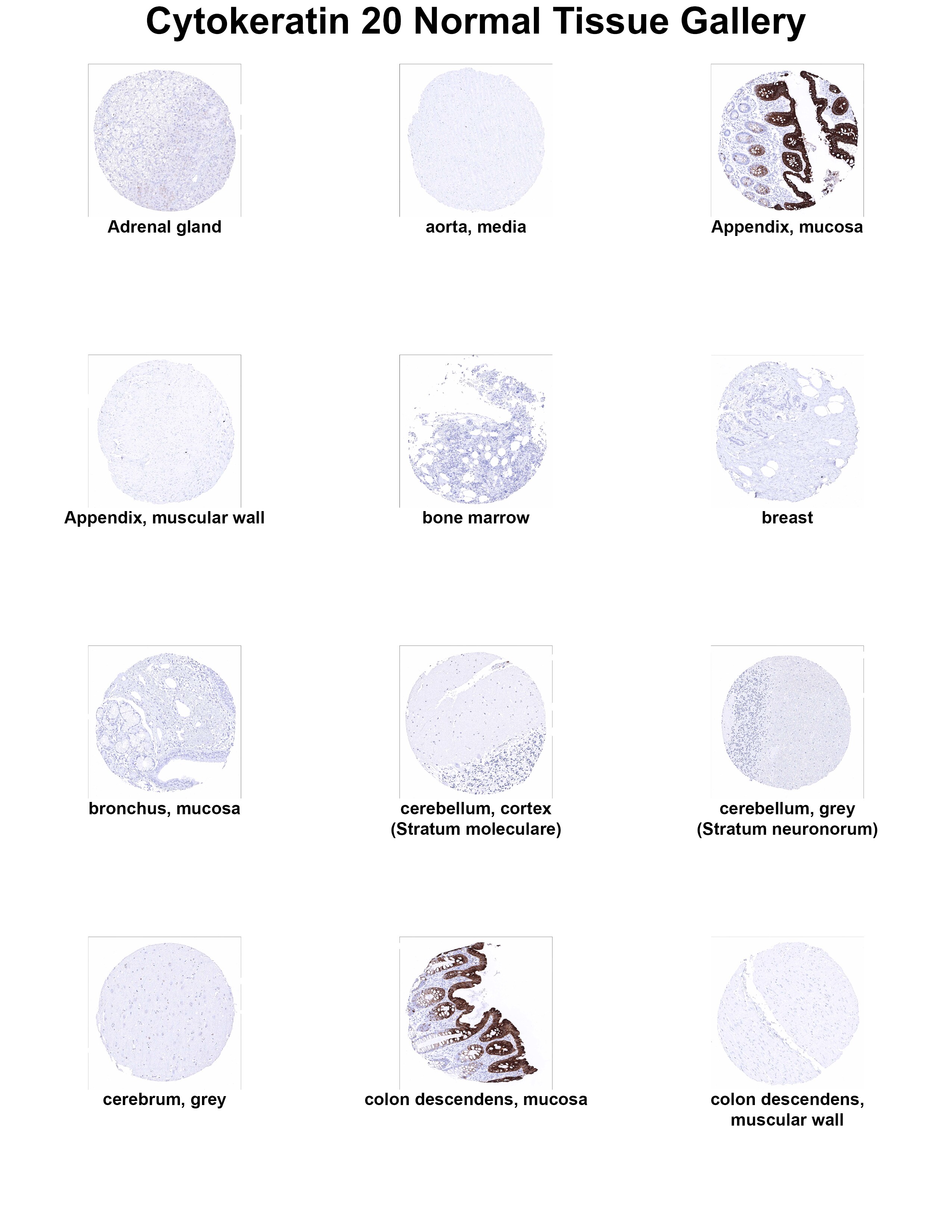Cytokeratin 20 Antibody (MSVA-620R) Cytokeratin 20 Antibody (MSVA-620R) Cytokeratin 20 Normal Tissue Gallery