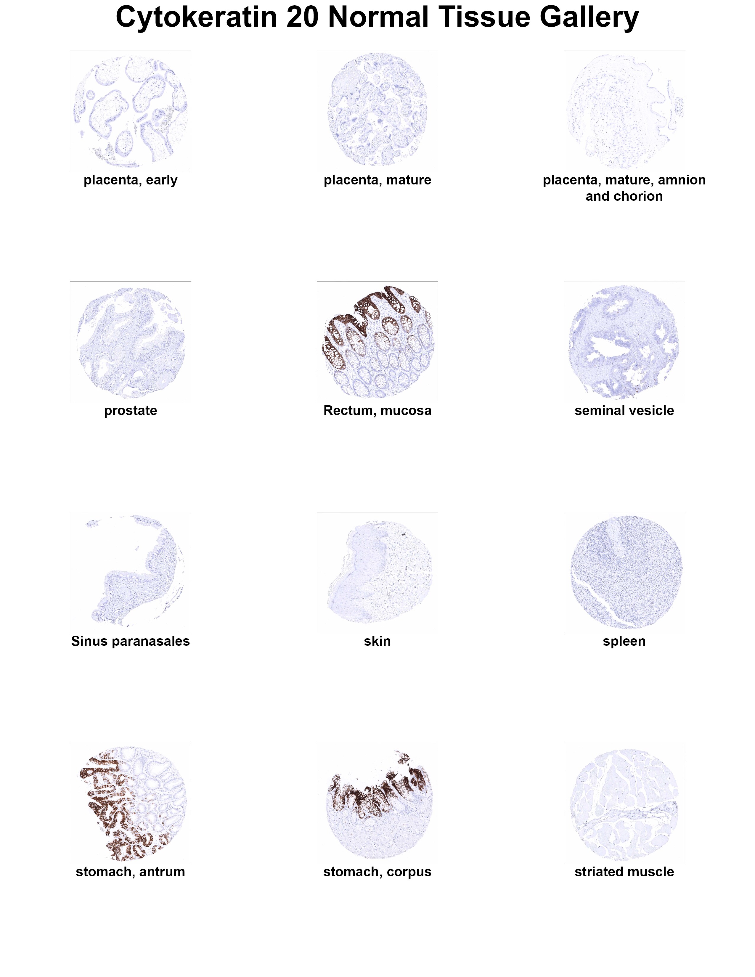 Cytokeratin 20 Antibody (MSVA-620R) Cytokeratin 20 Antibody (MSVA-620R) Cytokeratin 20 Normal Tissue Gallery