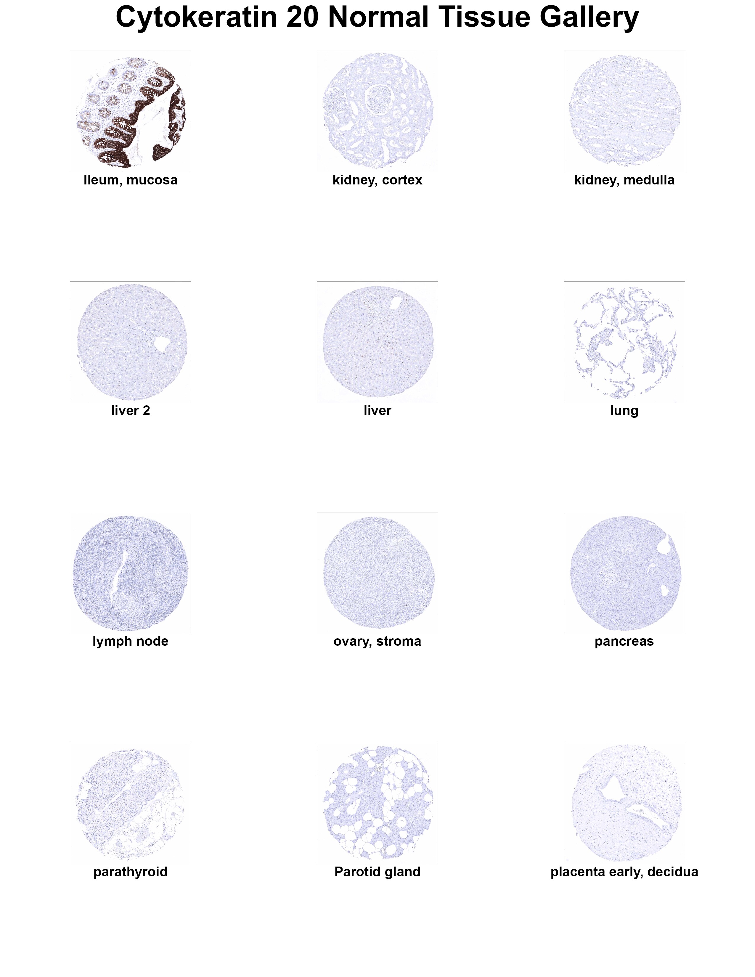 Cytokeratin 20 Antibody (MSVA-620R) Cytokeratin 20 Antibody (MSVA-620R) Cytokeratin 20 Normal Tissue Gallery