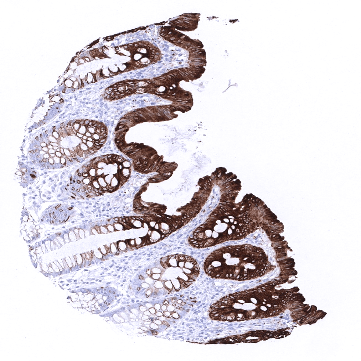 Cytokeratin 20 Antibody (MSVA-620R)