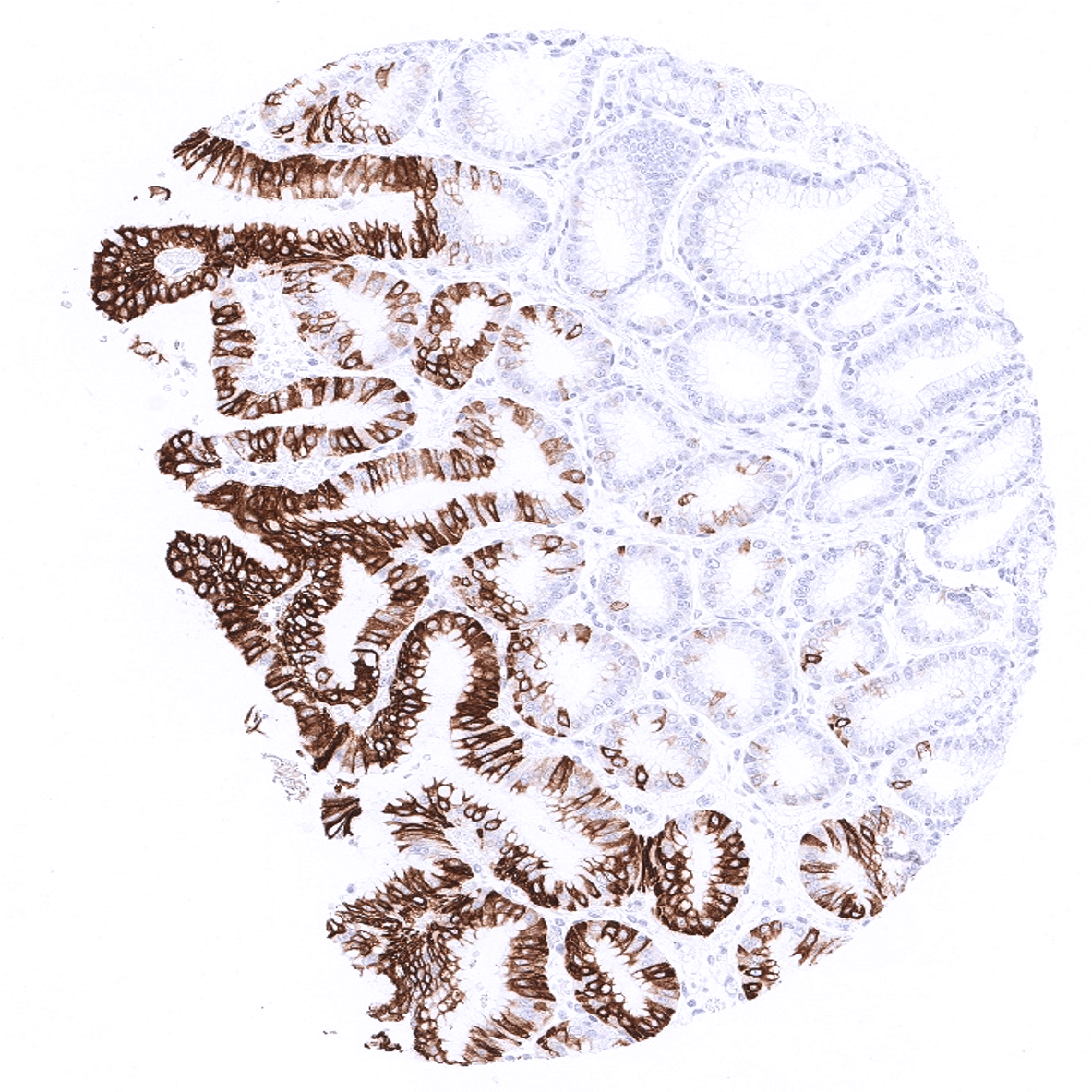 Cytokeratin 20 Antibody (MSVA-620R)