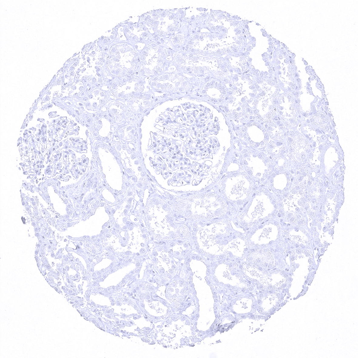 Cytokeratin 20 Antibody (MSVA-620R)