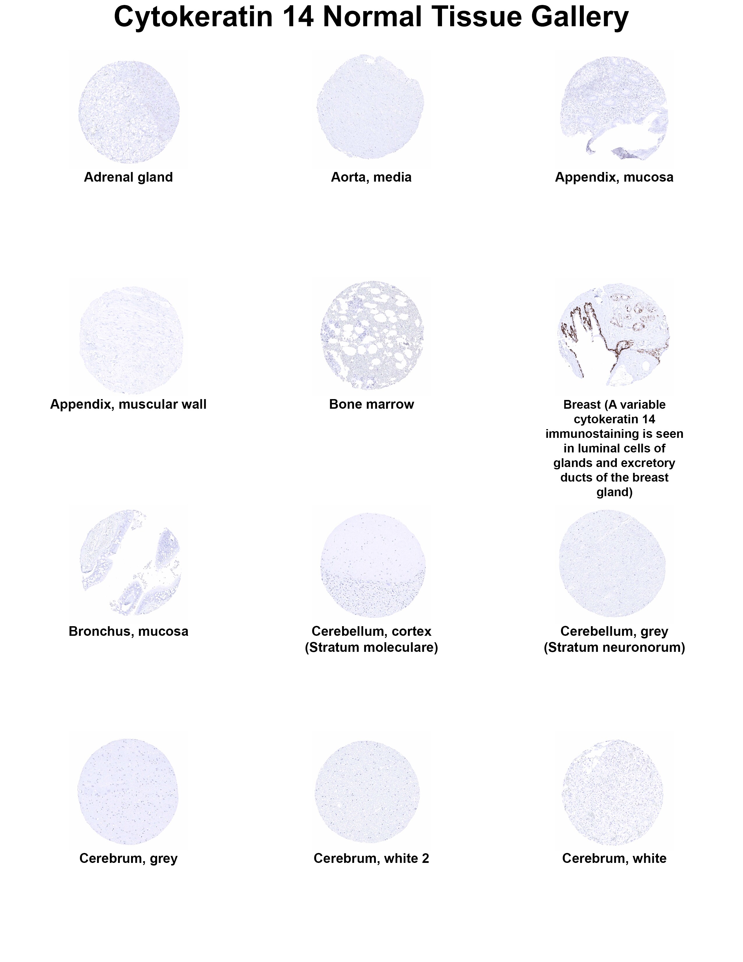 Cytokeratin 14 Antibody (MSVA-614R) Cytokeratin 14 Antibody (MSVA-614R) Cytokeratin 14 Normal Tissue Gallery