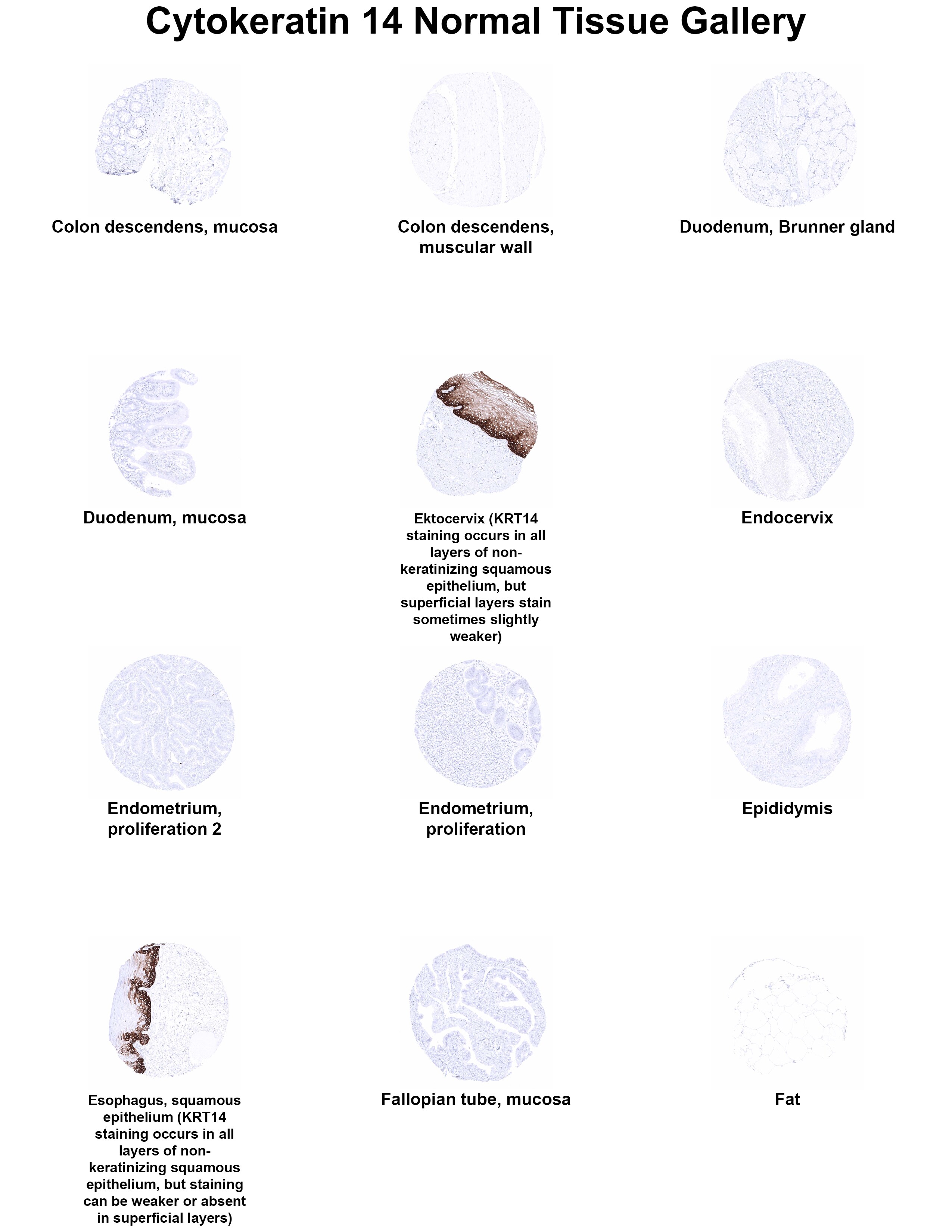 Cytokeratin 14 Antibody (MSVA-614R) Cytokeratin 14 Antibody (MSVA-614R) Cytokeratin 14 Normal Tissue Gallery