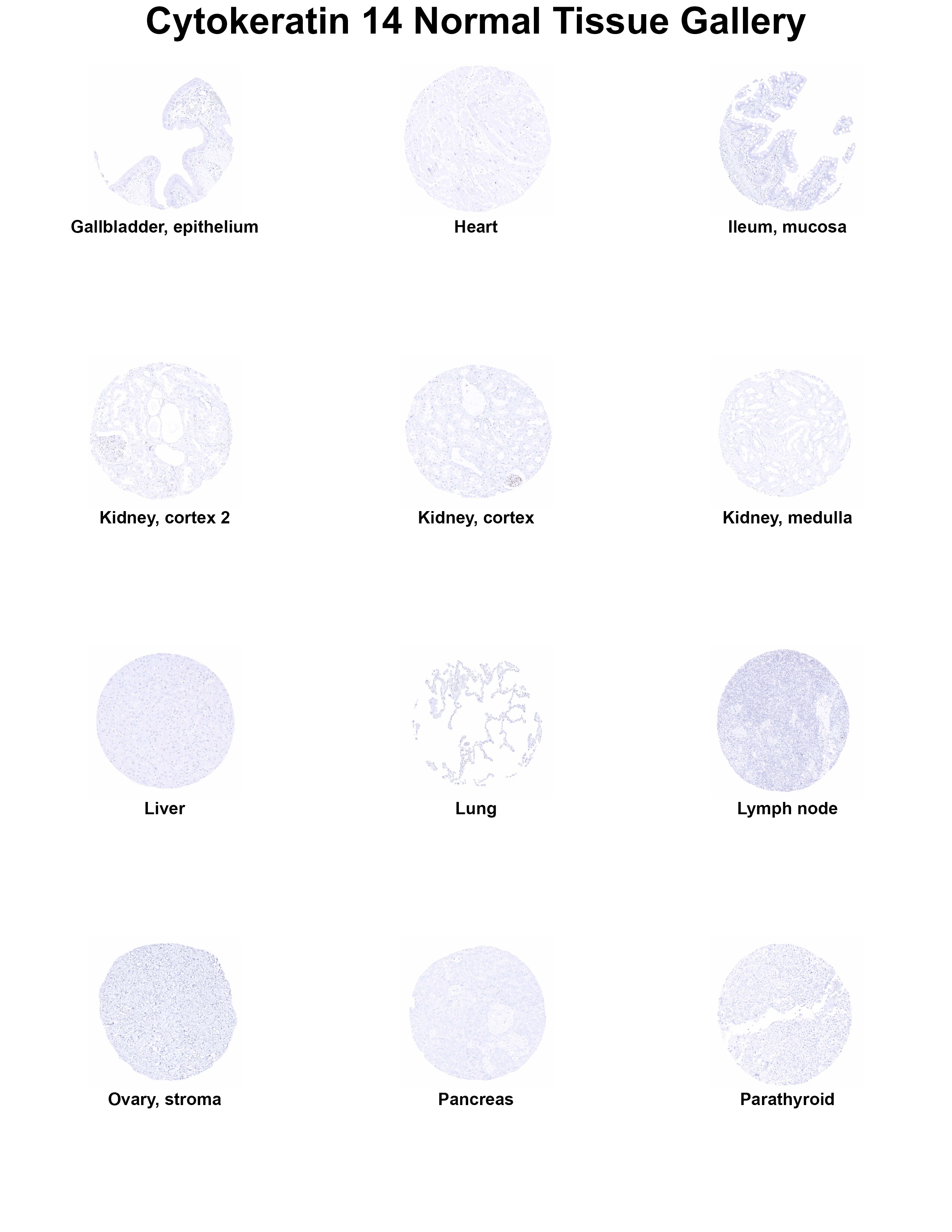 Cytokeratin 14 Antibody (MSVA-614R) Cytokeratin 14 Antibody (MSVA-614R) Cytokeratin 14 Normal Tissue Gallery
