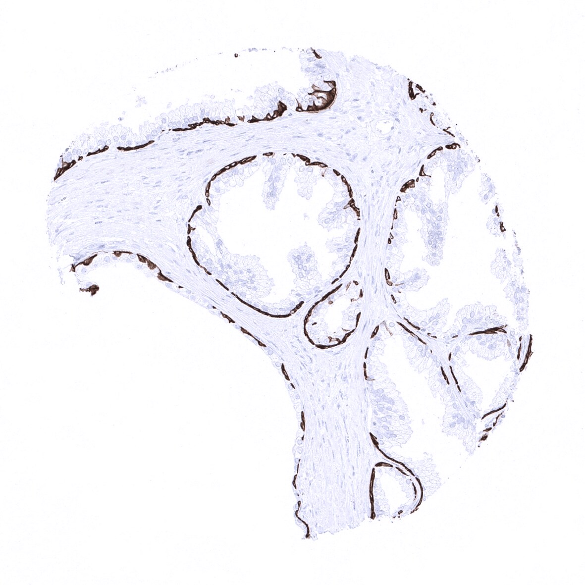 Cytokeratin 14 Antibody (MSVA-614R)
