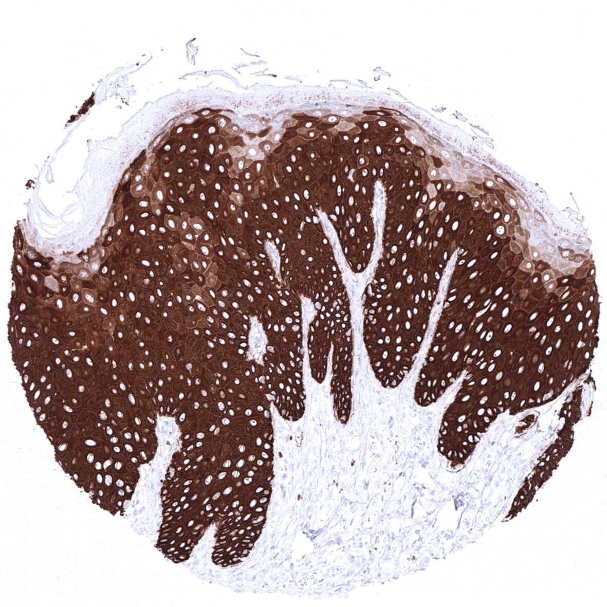 Cytokeratin 14 Antibody (MSVA-614R)