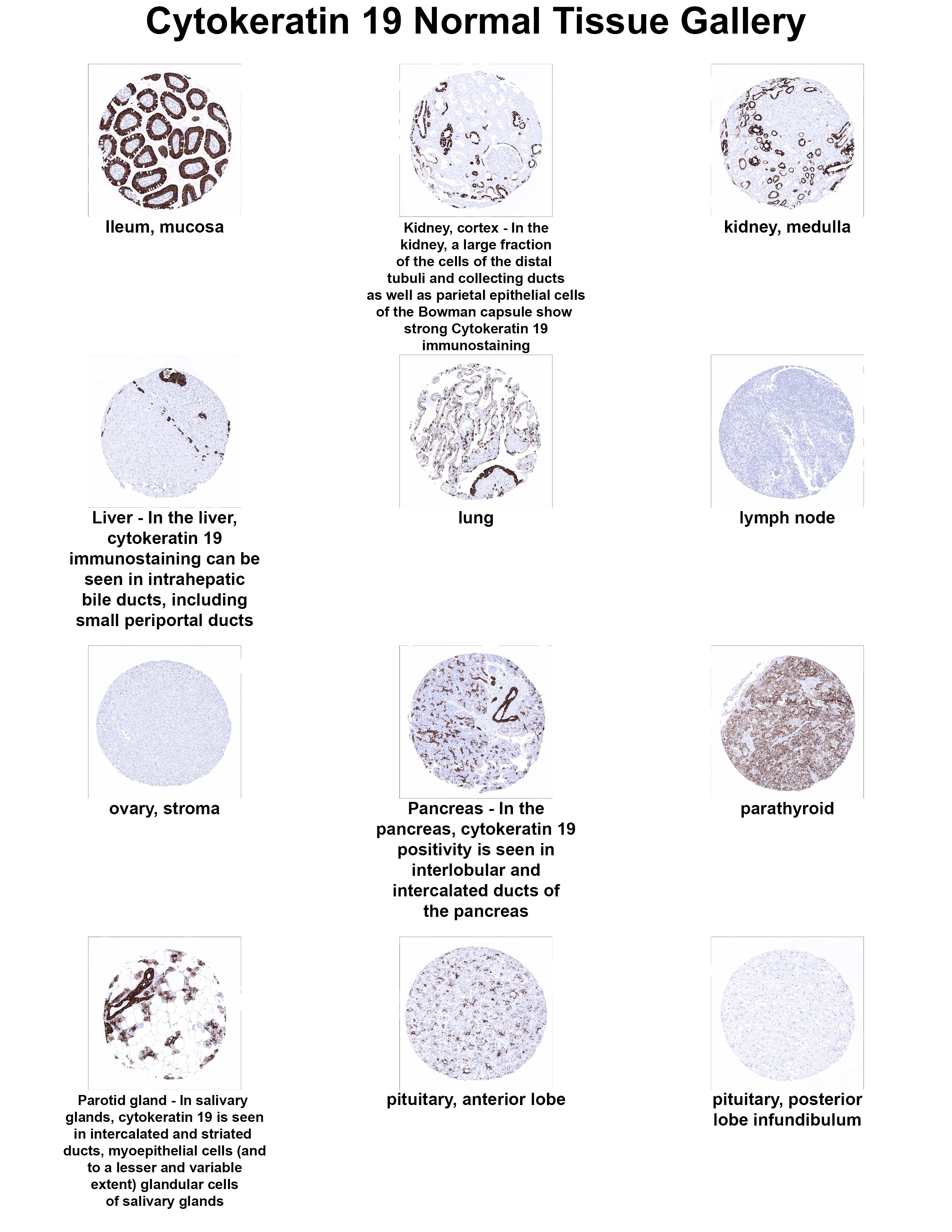 Cytokeratin 19 Antibody (MSVA-119M) Cytokeratin 19 Antibody (MSVA-119M) Cytokeratin 19 Normal Tissue Gallery