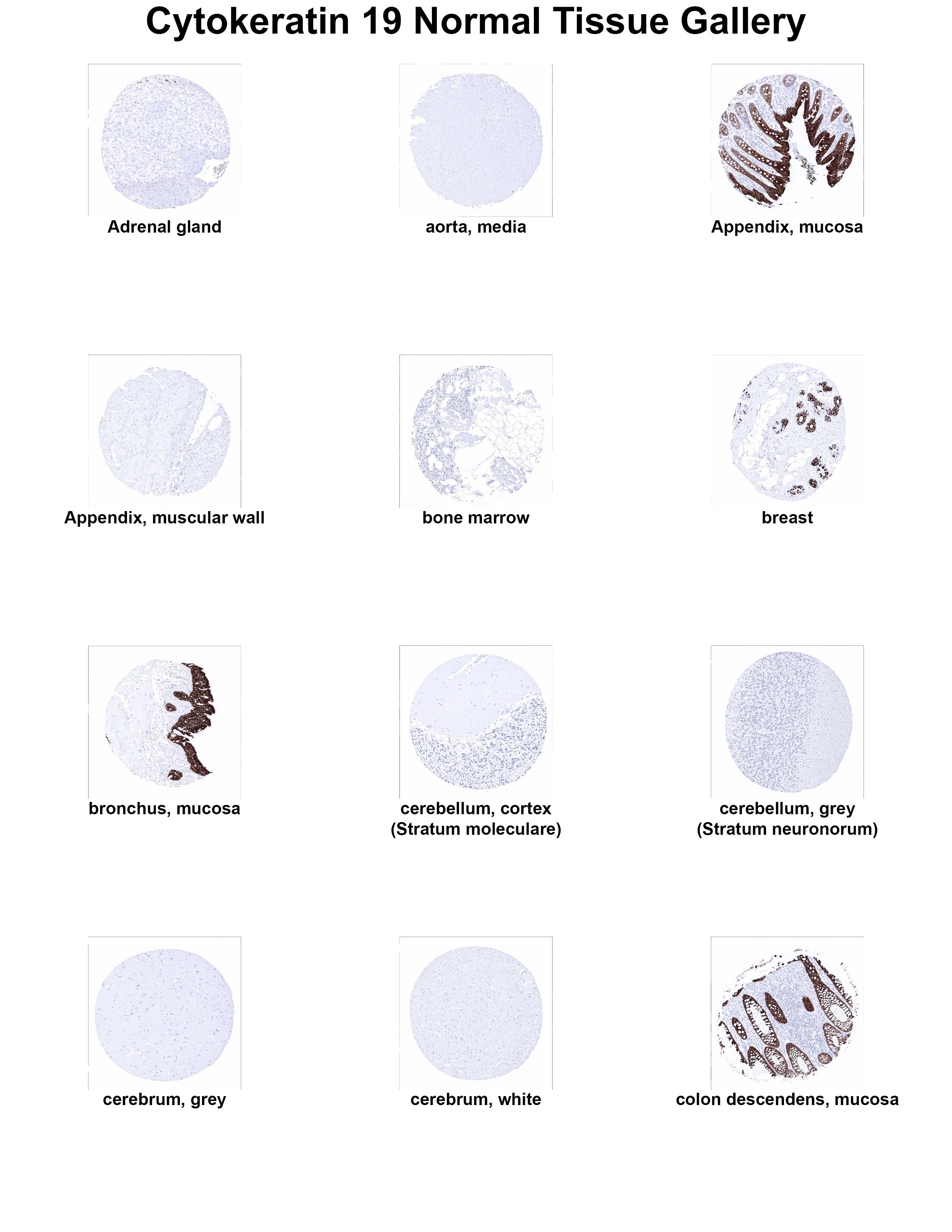 Cytokeratin 19 Antibody (MSVA-119M) Cytokeratin 19 Antibody (MSVA-119M) Cytokeratin 19 Normal Tissue Gallery