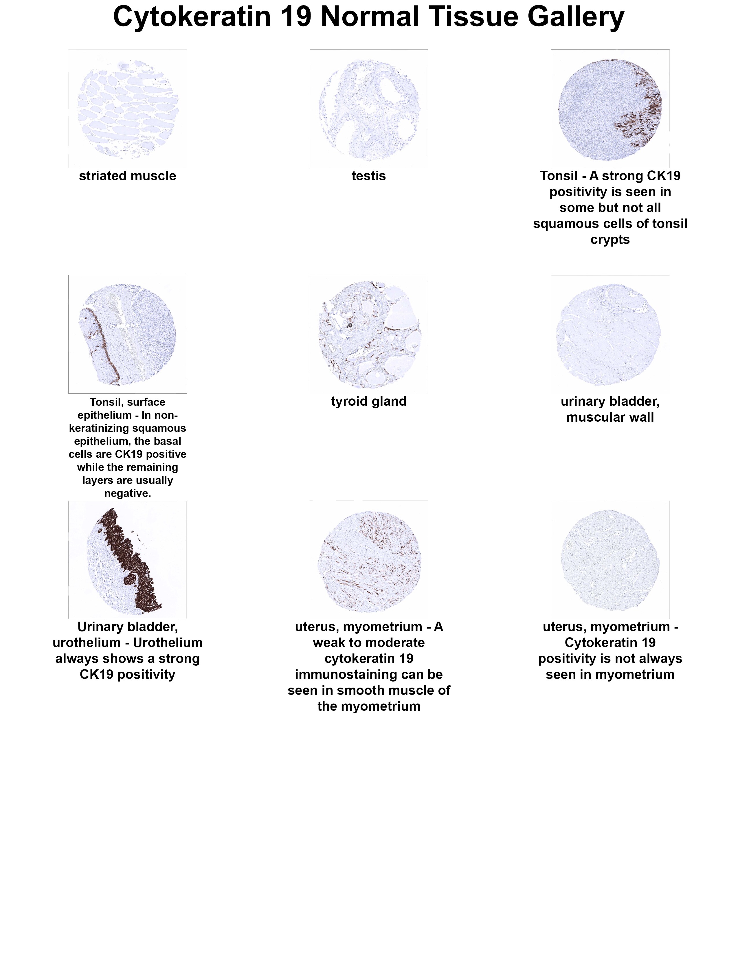 Cytokeratin 19 Antibody (MSVA-119M) Cytokeratin 19 Antibody (MSVA-119M) Cytokeratin 19 Normal Tissue Gallery