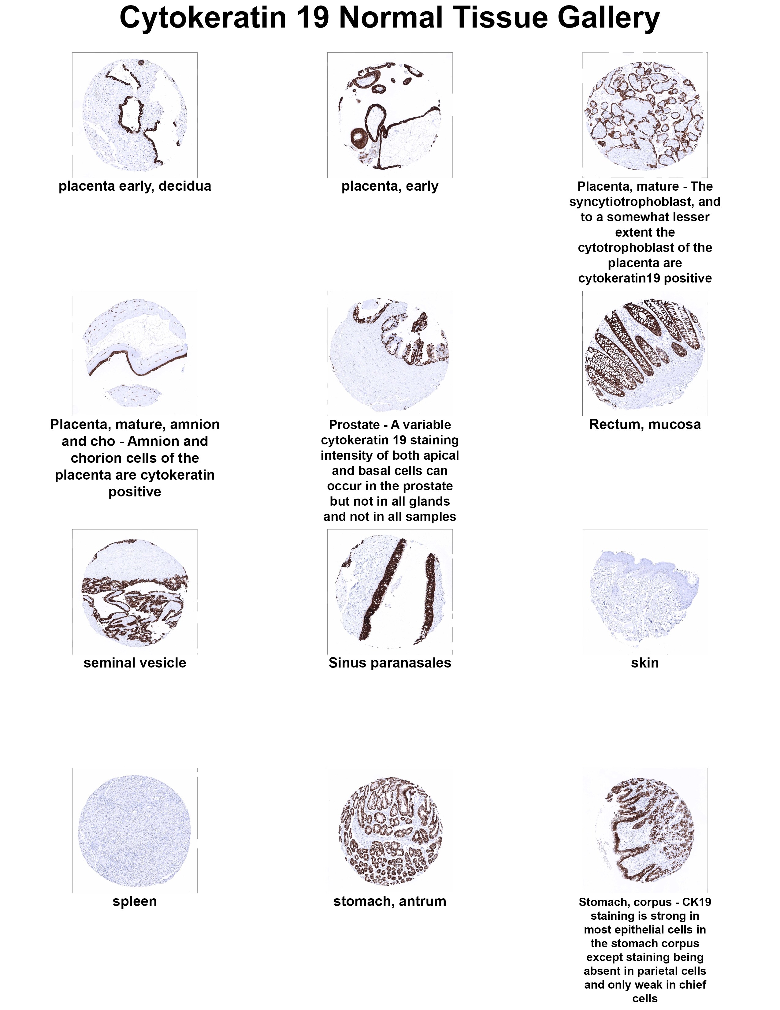 Cytokeratin 19 Antibody (MSVA-119M) Cytokeratin 19 Antibody (MSVA-119M) Cytokeratin 19 Normal Tissue Gallery